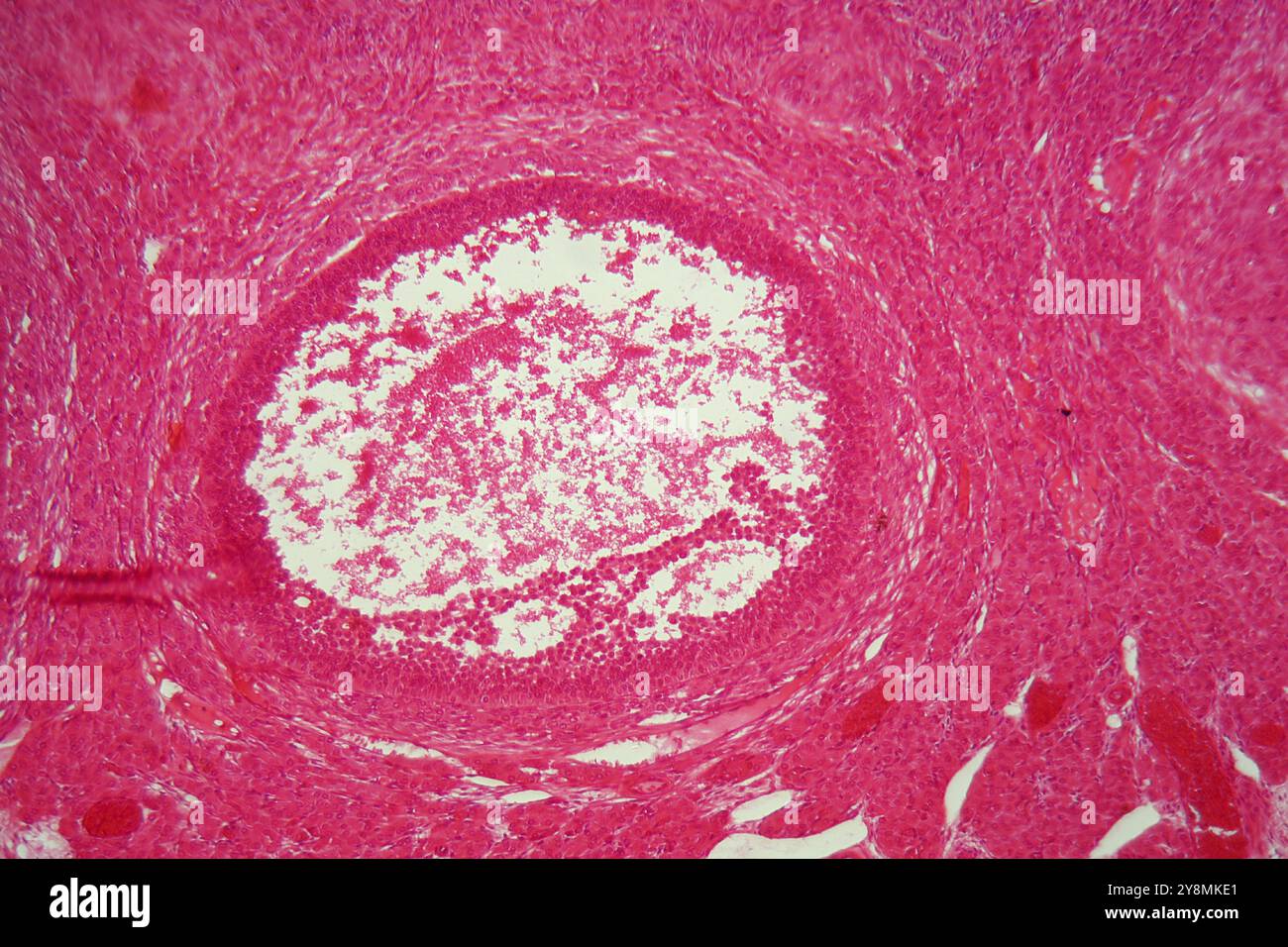 Una sezione attraverso le cellule ovariche sotto il microscopio Foto Stock