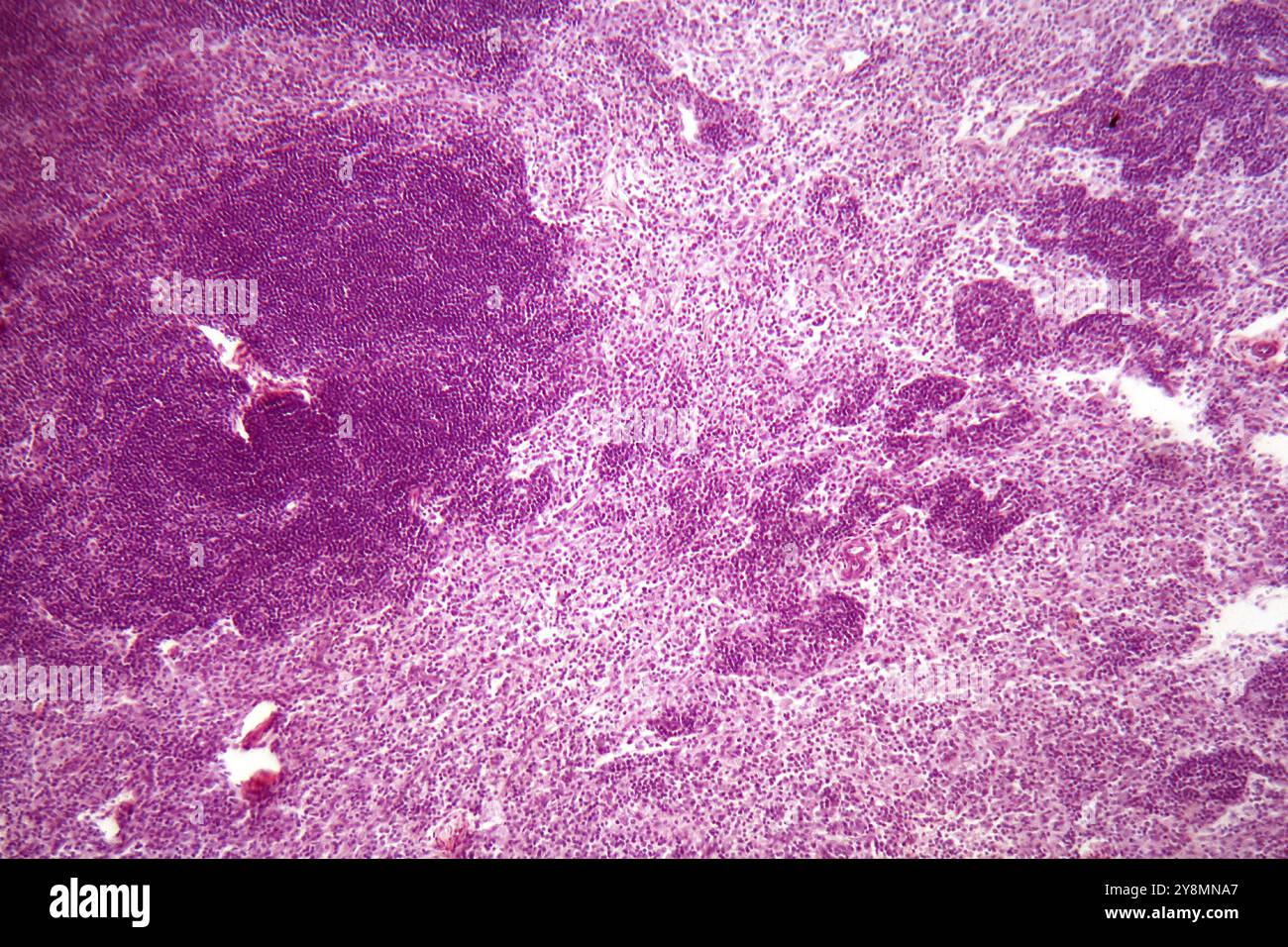 Una sezione attraverso le cellule linfonodali sotto il microscopio Foto Stock