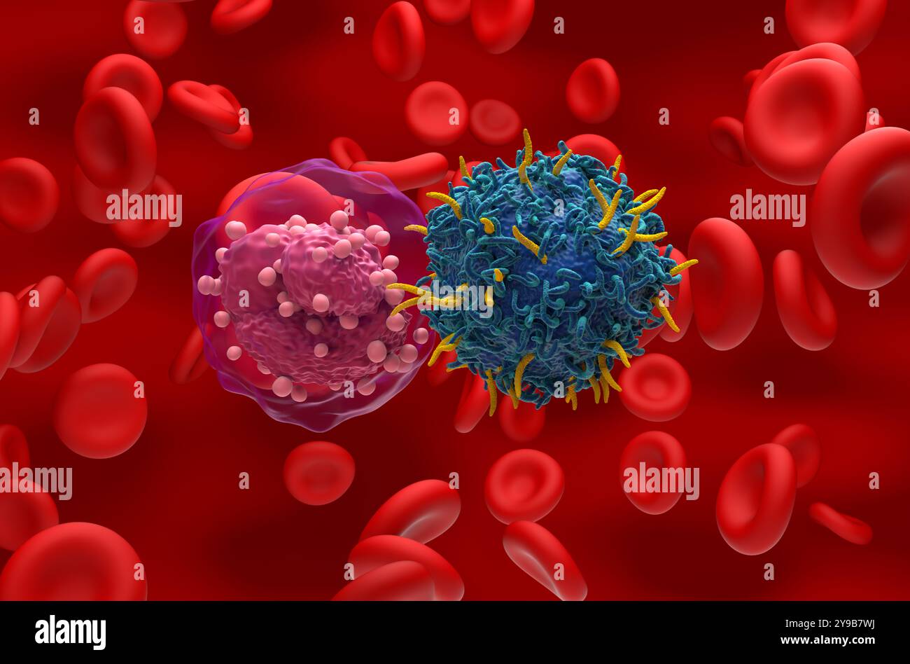Terapia con cellule T DELL'AUTO nella leucemia linfocitica acuta (TUTTE) - Vista ravvicinata illustrazione 3d. Foto Stock