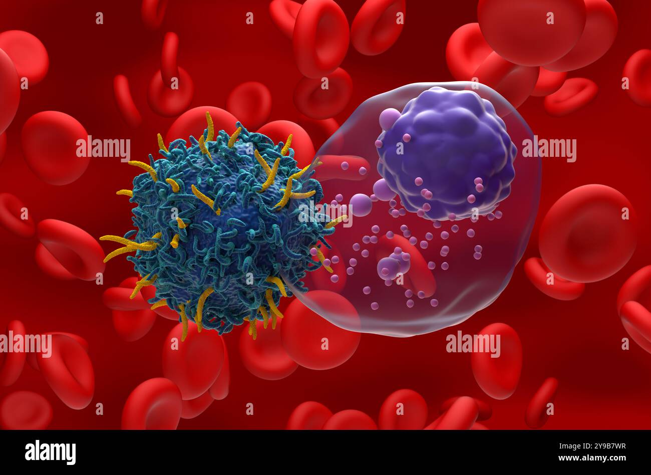Terapia con cellule T DELL'AUTO nel mieloma multiplo (MM) - Vista ravvicinata illustrazione 3d. Foto Stock