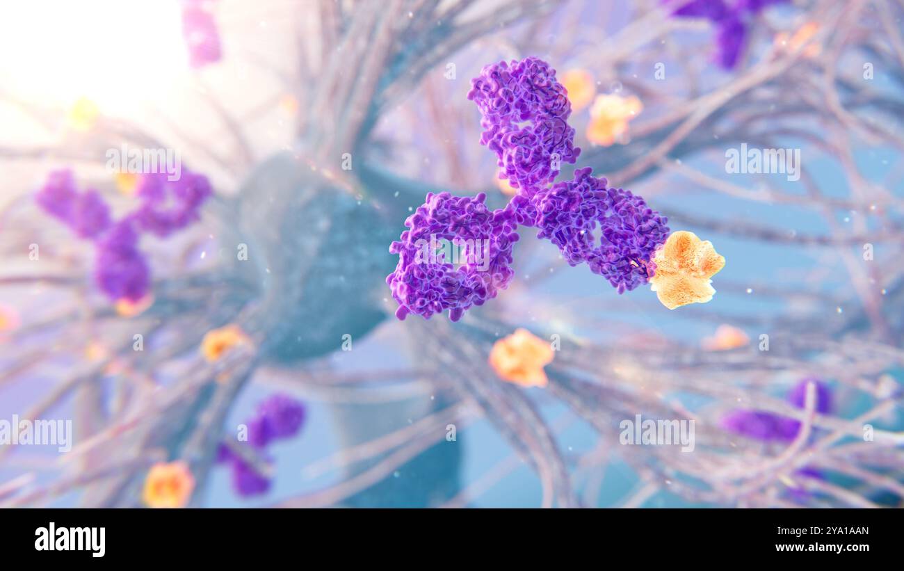 Immagine di un anticorpo (viola) che si lega alla proteina amiloide (giallo/arancione). Gli anticorpi anti-amiloidi sono una classe di anticorpi sviluppati per trattare il morbo di Alzheimer. Foto Stock