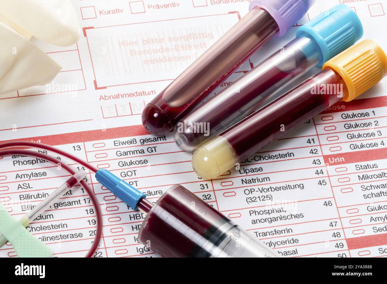 I campioni di sangue vengono prelevati sotto forma di laboratorio per determinare i valori ematici Foto Stock