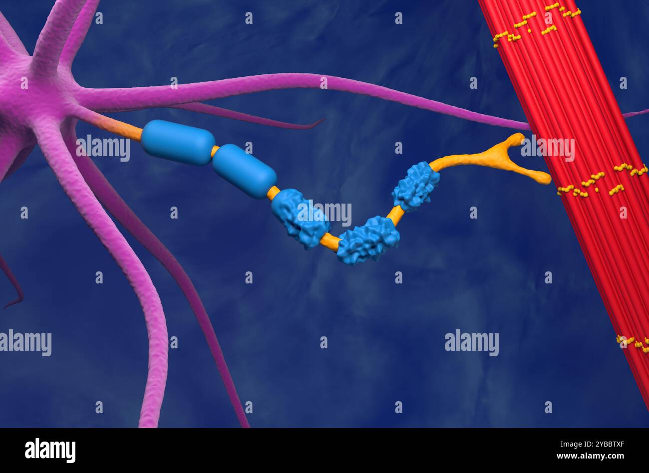 Neurone del motore danneggiato dalla sclerosi laterale amiotrofica (ALS) - Vista ravvicinata dell'illustrazione 3d. Foto Stock