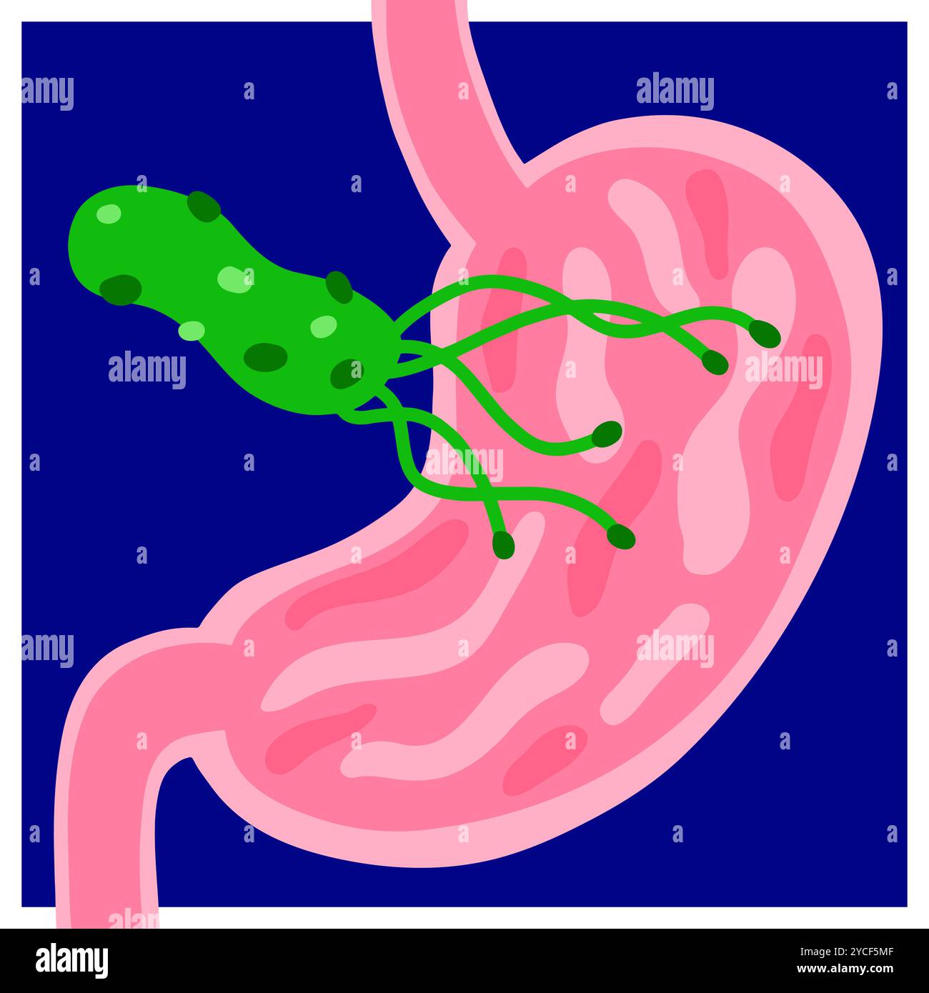 Illustrazione vettoriale Helicobacter pylori. Stomaco disegnato a mano, batteri. Immagine medica informativa brillante. Malattia dello stomaco, duodeno, esofago Illustrazione Vettoriale