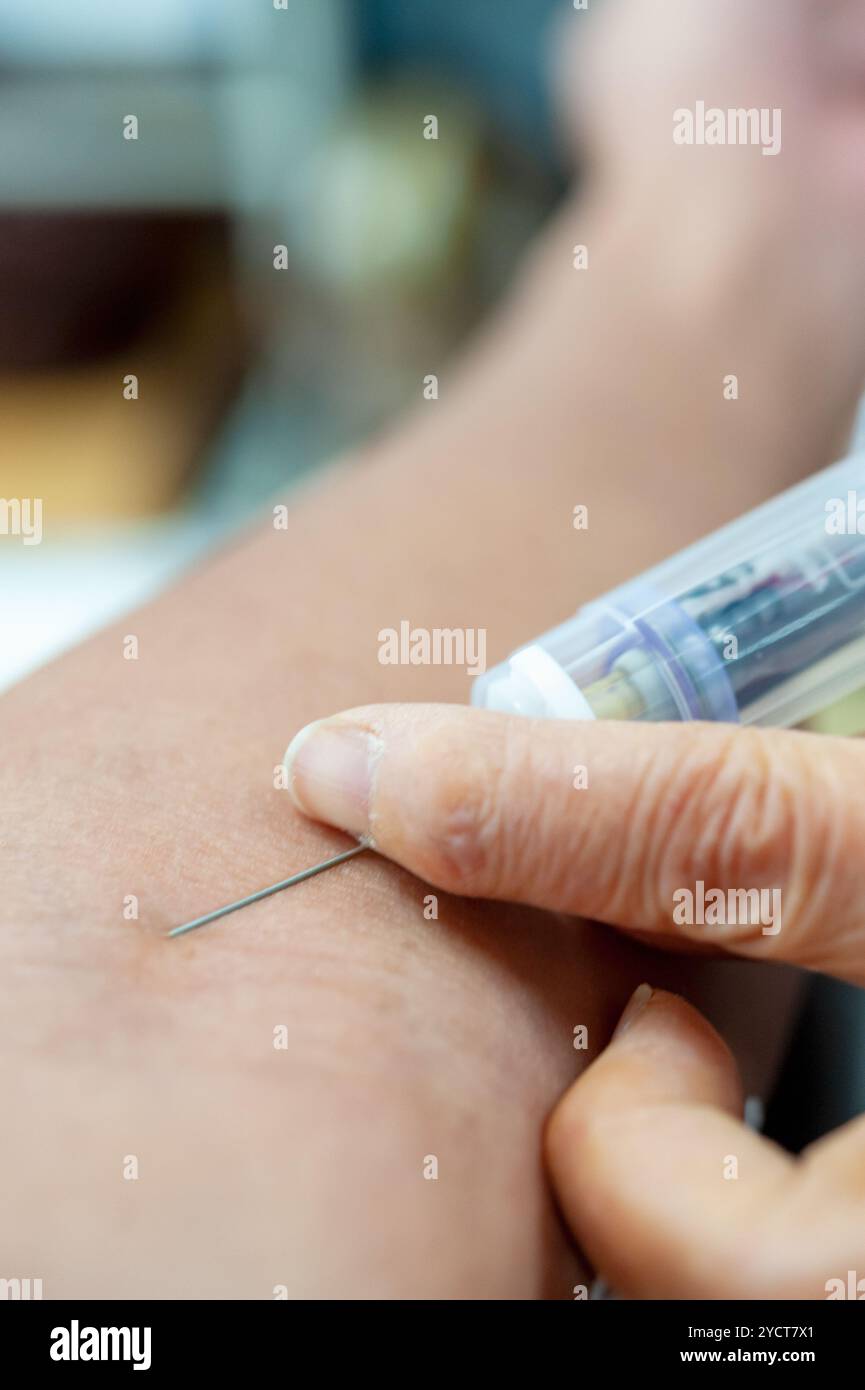 Siringhe e aghi per il prelievo ematico Foto Stock