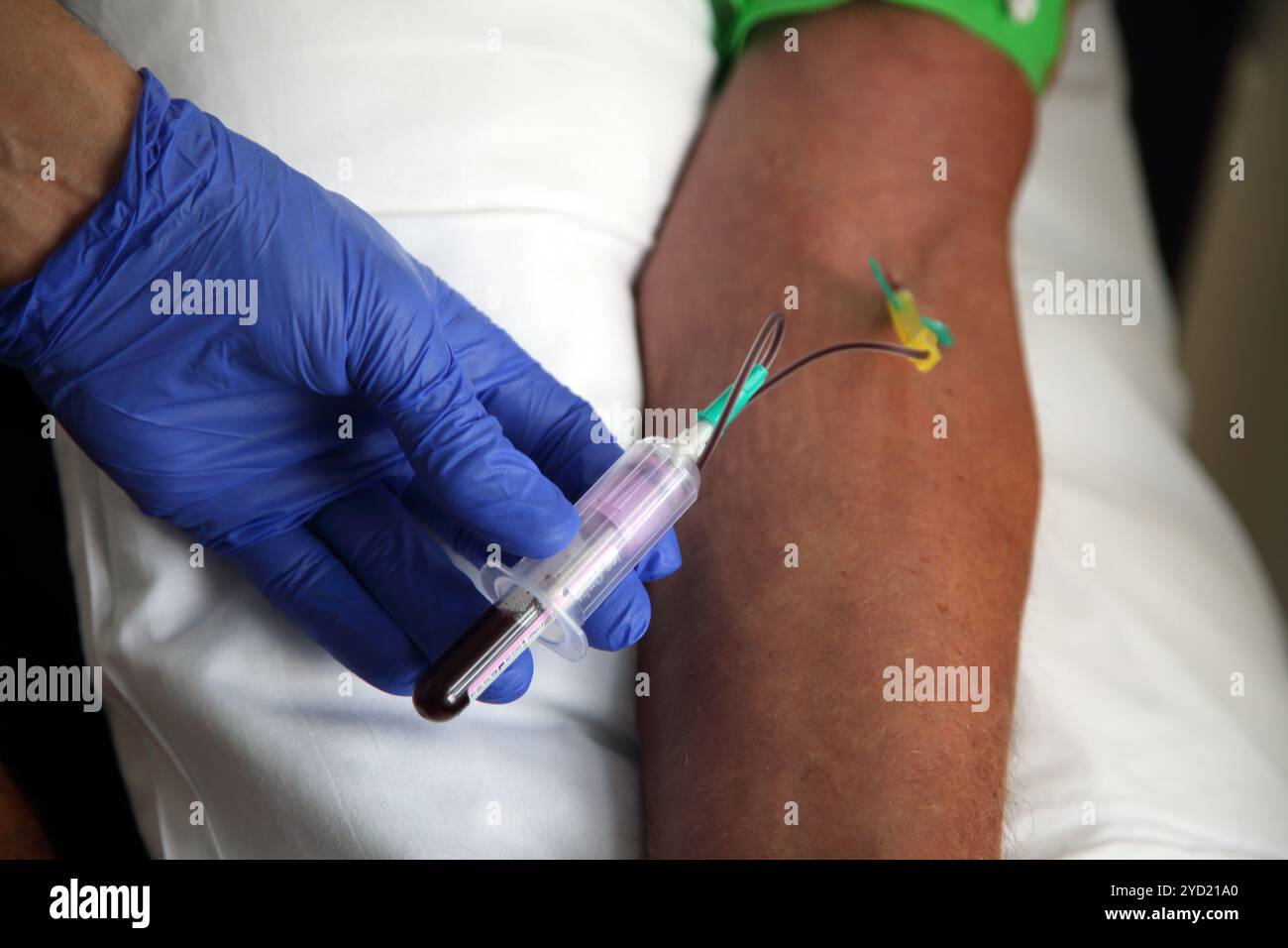 Infermiere che preleva il sangue del paziente utilizzando una siringa e un ago a farfalla (set per infusione con alette) Foto Stock