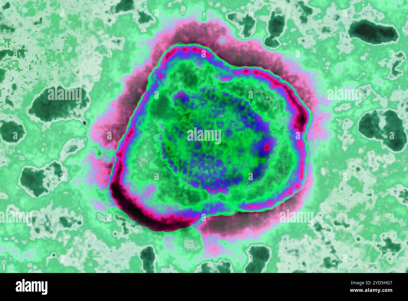 Herpes virus (HSV. HSV è la causa di herpes labiale, herpes genitale, varicella, mononucleosi infettiva, roseola, a volte il herpes zoster. Foto Stock