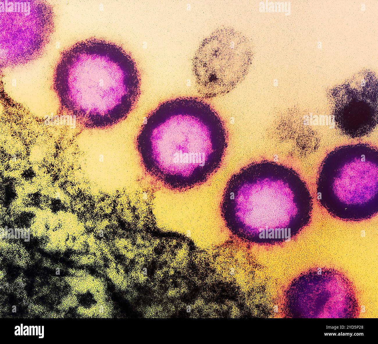 Micrografia elettronica di trasmissione di particelle del virus HIV-1 (rosa) che si replicano dalla membrana plasmatica di una cellula H9 T infetta. Foto Stock