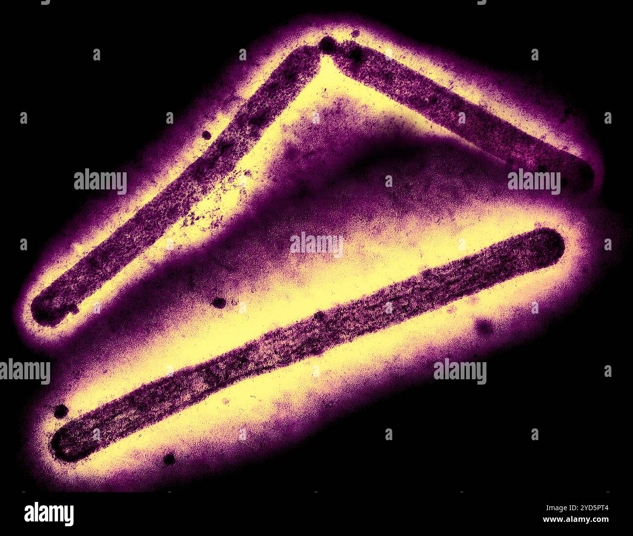 Tre particelle del virus dell'influenza A (H5N1/influenza aviaria) (viola a forma di asta). Foto Stock