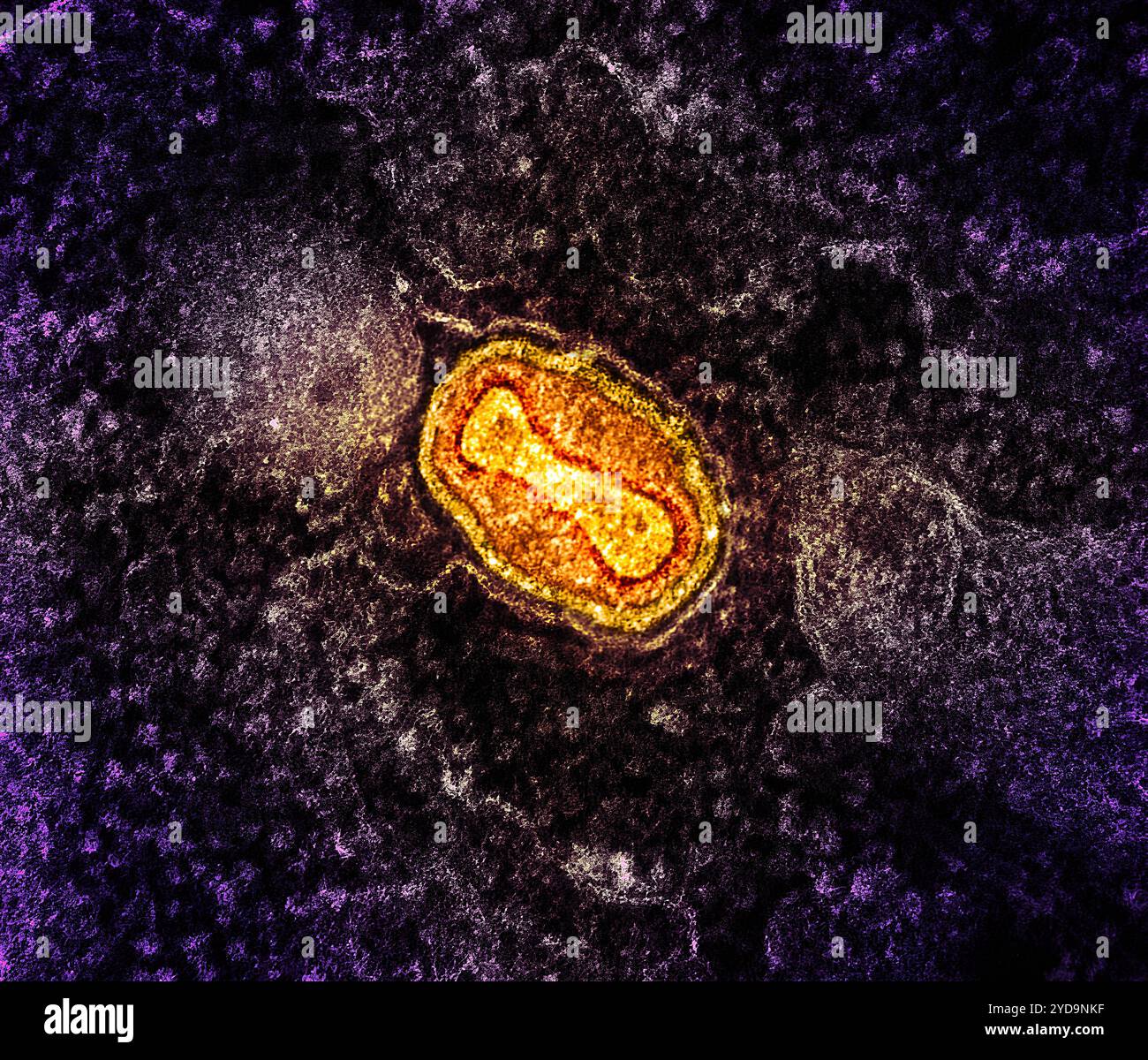 Micrografia elettronica a trasmissione colorata di una particella del virus mpox gialla e rossa trovata all'interno di una cellula di VERO E6 infetta viola, coltivata in laboratorio. Mpox virus Particle 016867_024 Foto Stock