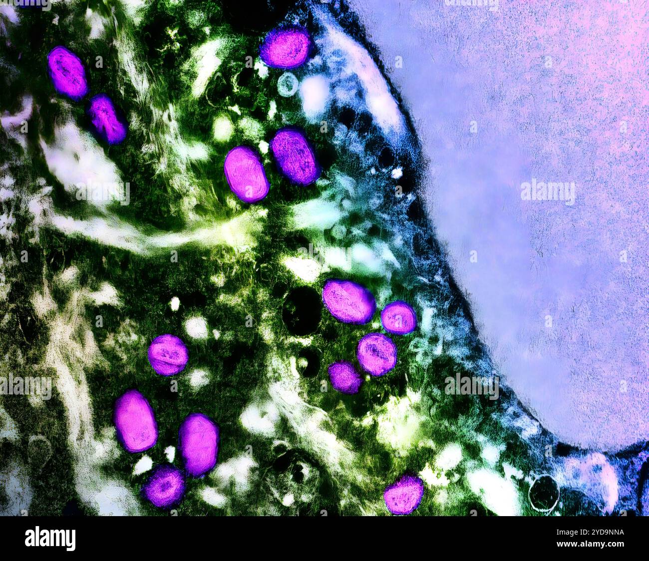 Micrografia elettronica a trasmissione colorata di particelle del virus mpox rosa/viola trovate all'interno di una cellula infetta verde, coltivata in laboratorio. Virus Mpox 016867_020 Foto Stock