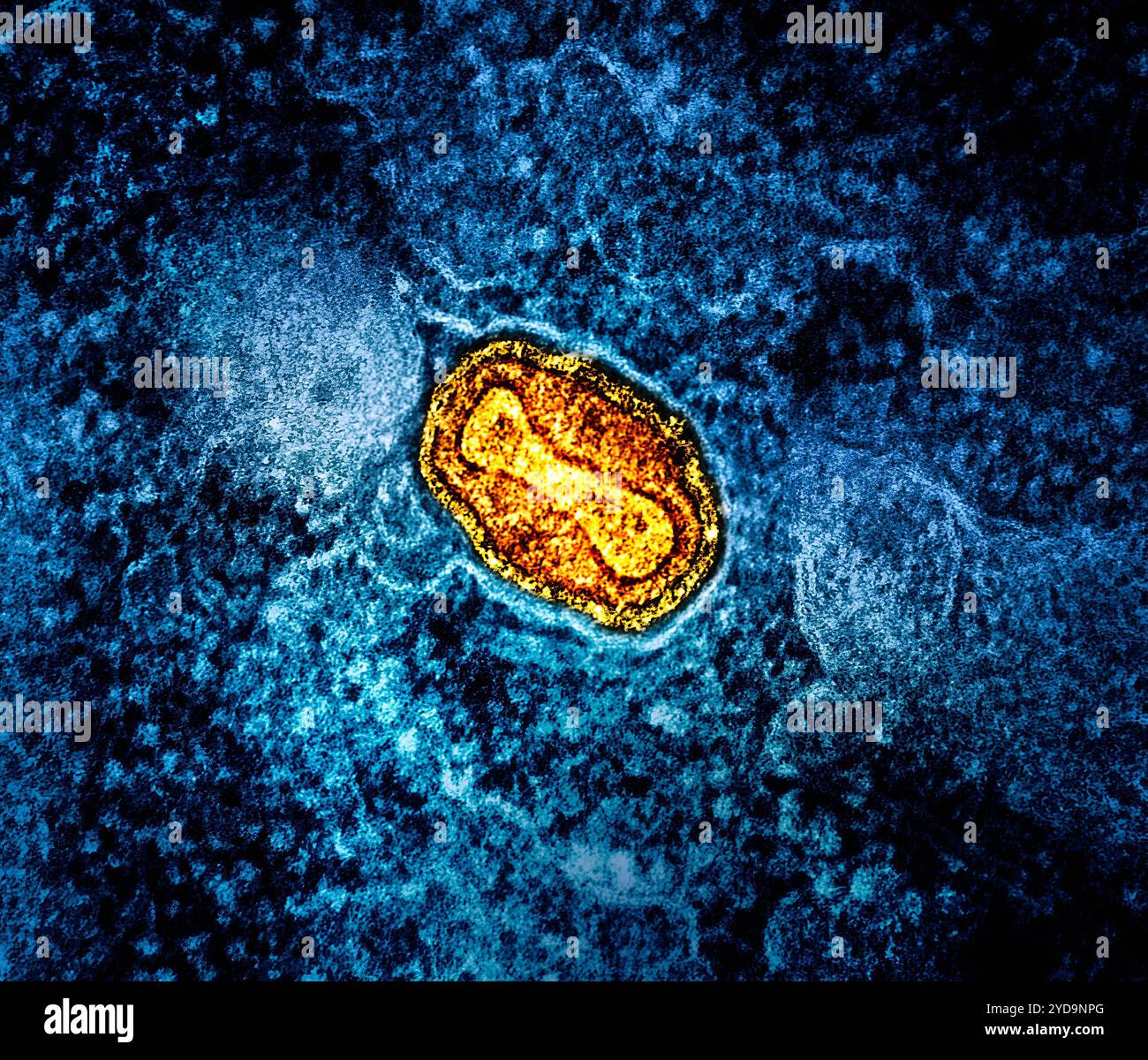 Micrografia elettronica a trasmissione colorata di una particella del virus mpox gialla e rossa trovata all'interno di una cellula infetta VERO E6 blu, coltivata in laboratorio. Mpox virus Particle 016867_025 Foto Stock
