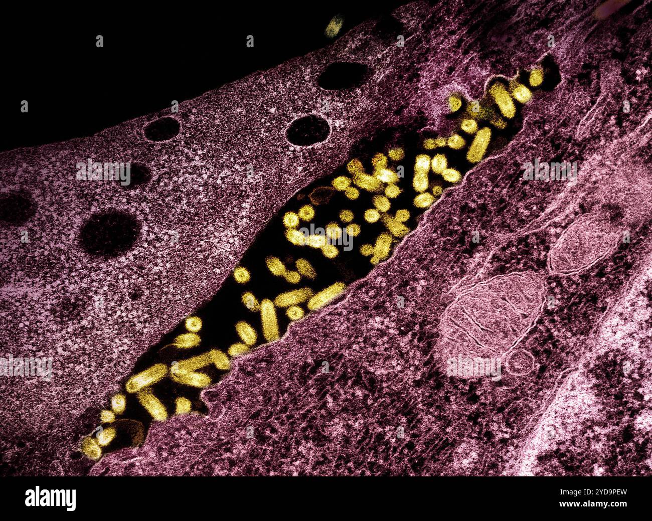 Micrografia elettronica di trasmissione che mostra il virus della stomatite vescicolare VSV particelle giallo budding da cellule infette Borgogna. Virus della stomatite vescicolare VSV 016867_075 Foto Stock