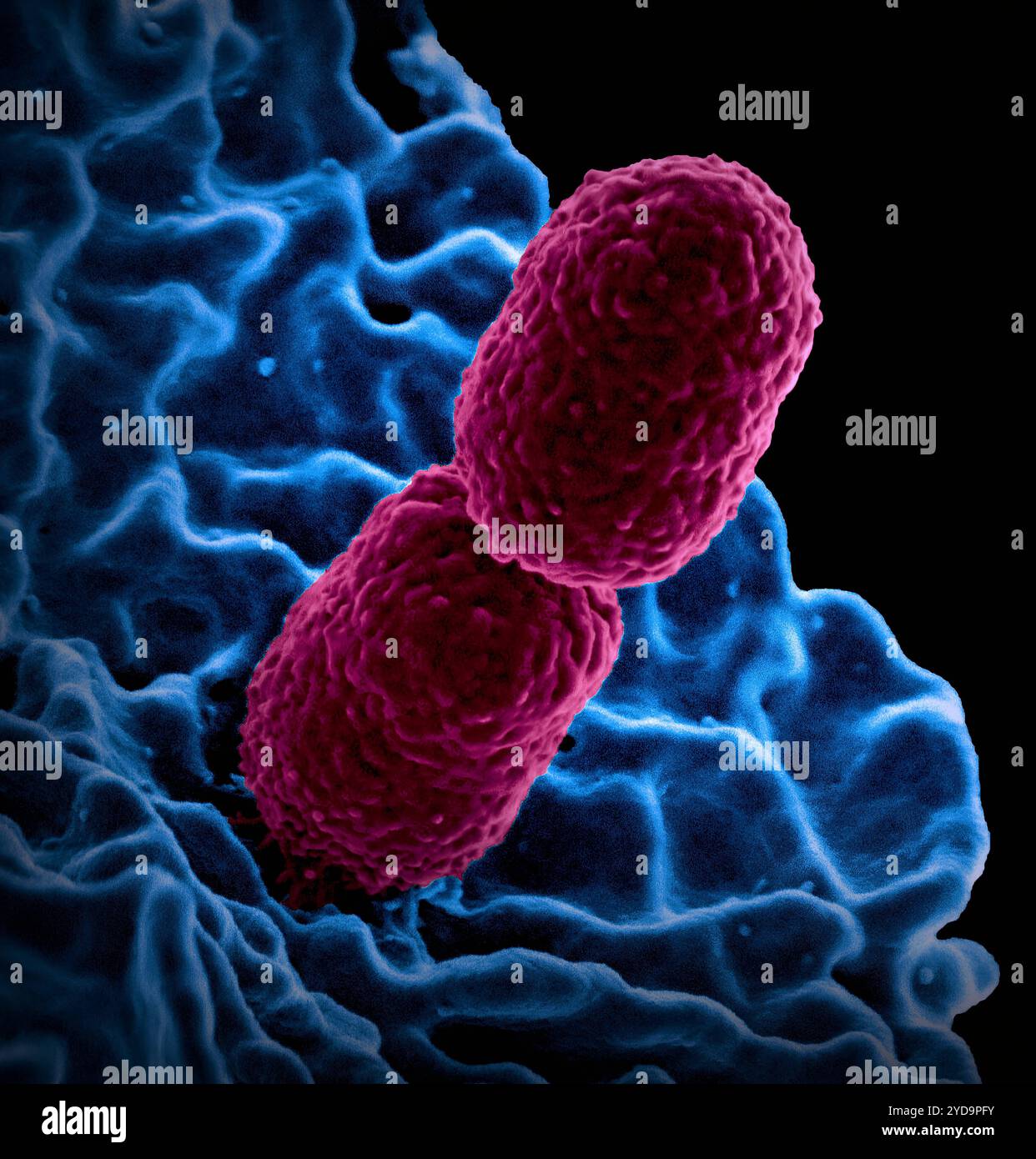 Micrografia elettronica a scansione colorata che mostra Klebsiella pneumoniae resistente ai carbapenei rosa che interagisce con un neutrofilo umano. Batteri Klebsiella pneumoniae 016867_071 Foto Stock