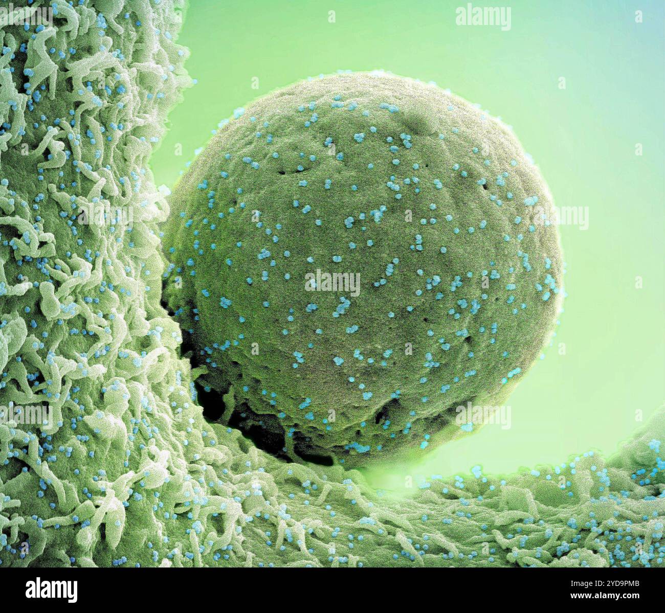Micrografia elettronica a scansione colorata di un verde cellulare infetto dal ceppo Omicron di particelle virali SARS-CoV-2 blu, isolato da un campione paziente. Nuovo Coronavirus SARS-CoV-2 Omicron 016867_101 Foto Stock