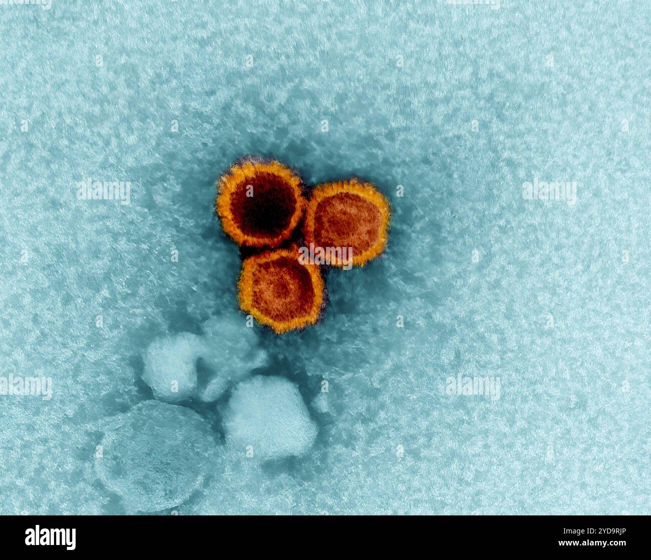 Un micrografo elettronico che mostra tre particelle EBV del virus Epstein-Barr colorate di rosso-arancione. 2024 : gli scienziati trovano punti deboli sul virus Epstein-Barr. Epstein-Barr virus EBV particelle 016867_189 Foto Stock
