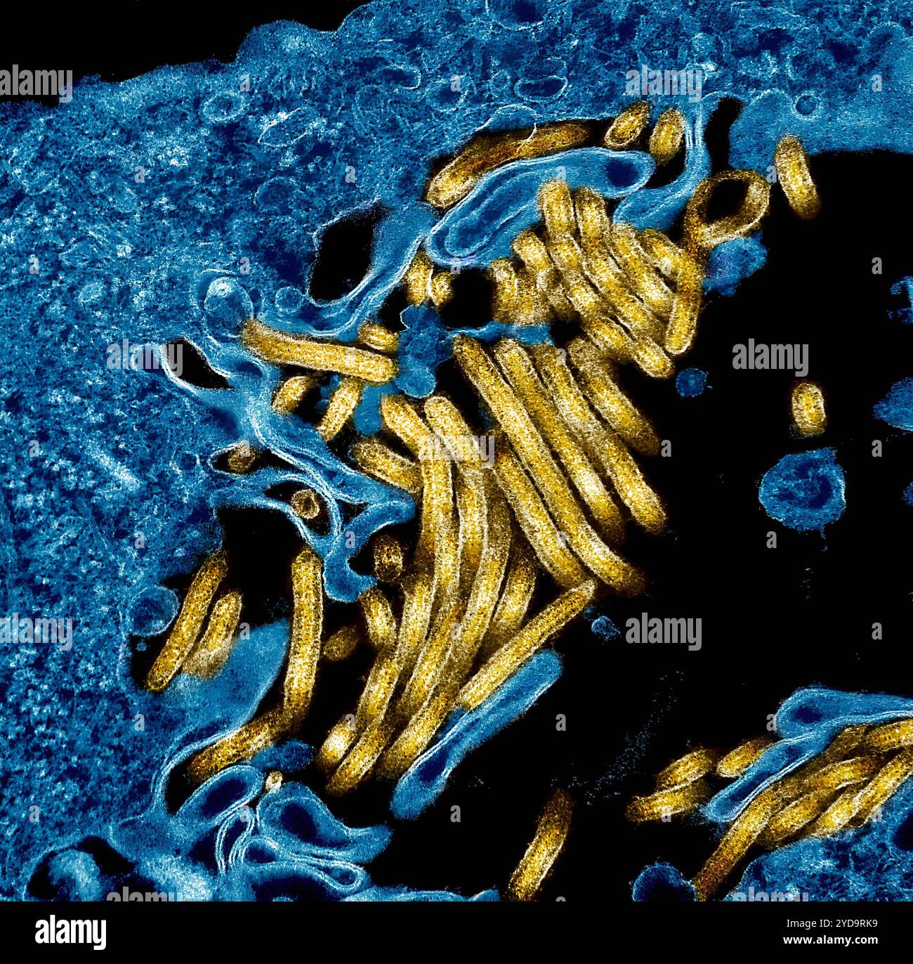 Micrografo elettronico a trasmissione colorata di particelle d'oro del virus Ebola trovato sia extracellularmente che in erba da cellule renali della scimmia verde africana cronicamente infette blu. 2024 : i vaccini sperimentali contro l'ebola sono stati ritenuti sicuri e in grado di produrre risposte immunitarie in adulti sani. Ebola virus Particles 016867_187 Foto Stock