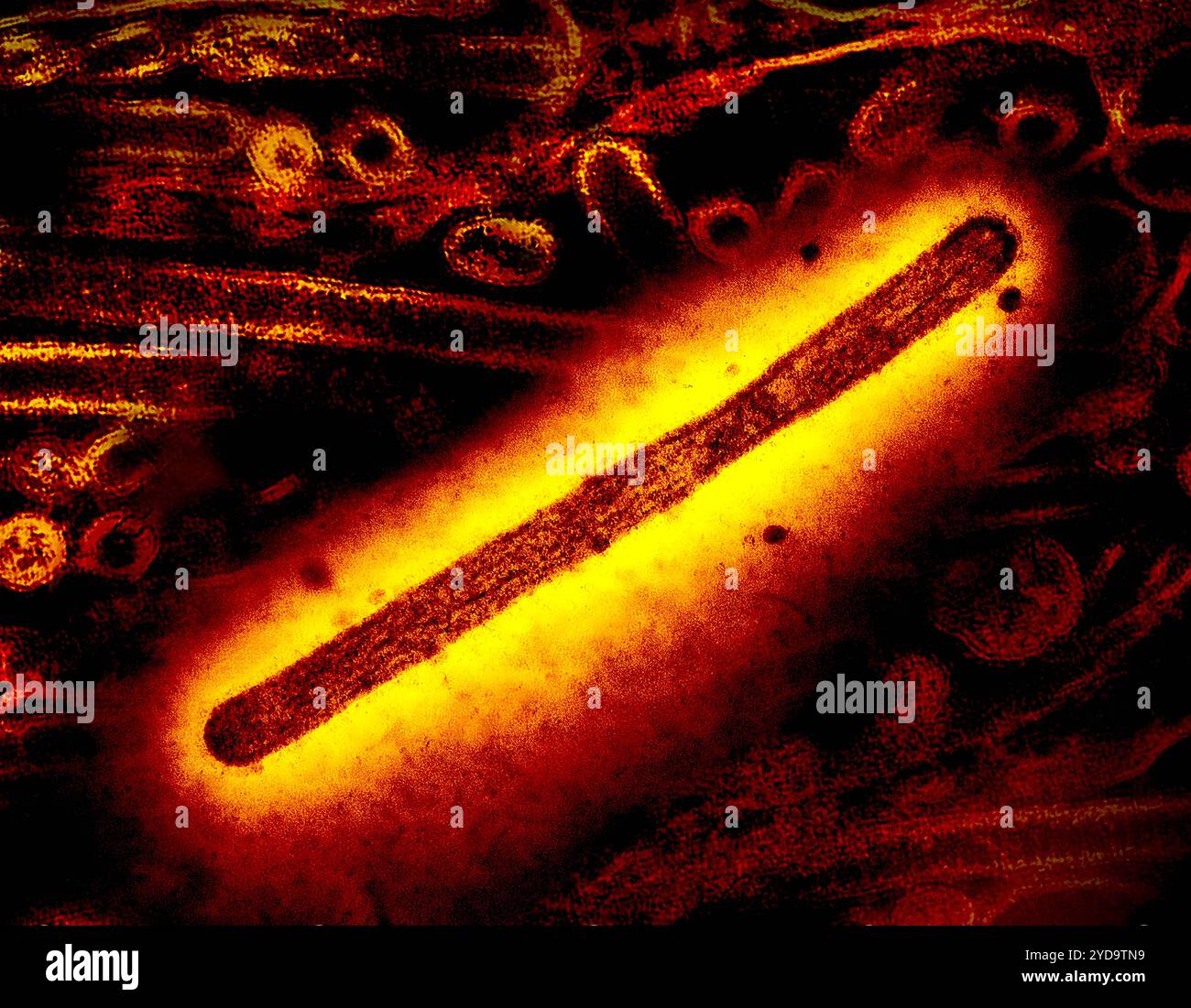 L'immagine del microscopio elettronico di trasmissione di un'influenza A forma di asta A H5N1/virus dell'influenza aviaria sullo sfondo è un secondo micrografo elettronico di trasmissione di particelle del virus H5N1 sia rotonde che a forma di asta. Influenza A virus H5N1/influenza aviaria 016867_313 Foto Stock