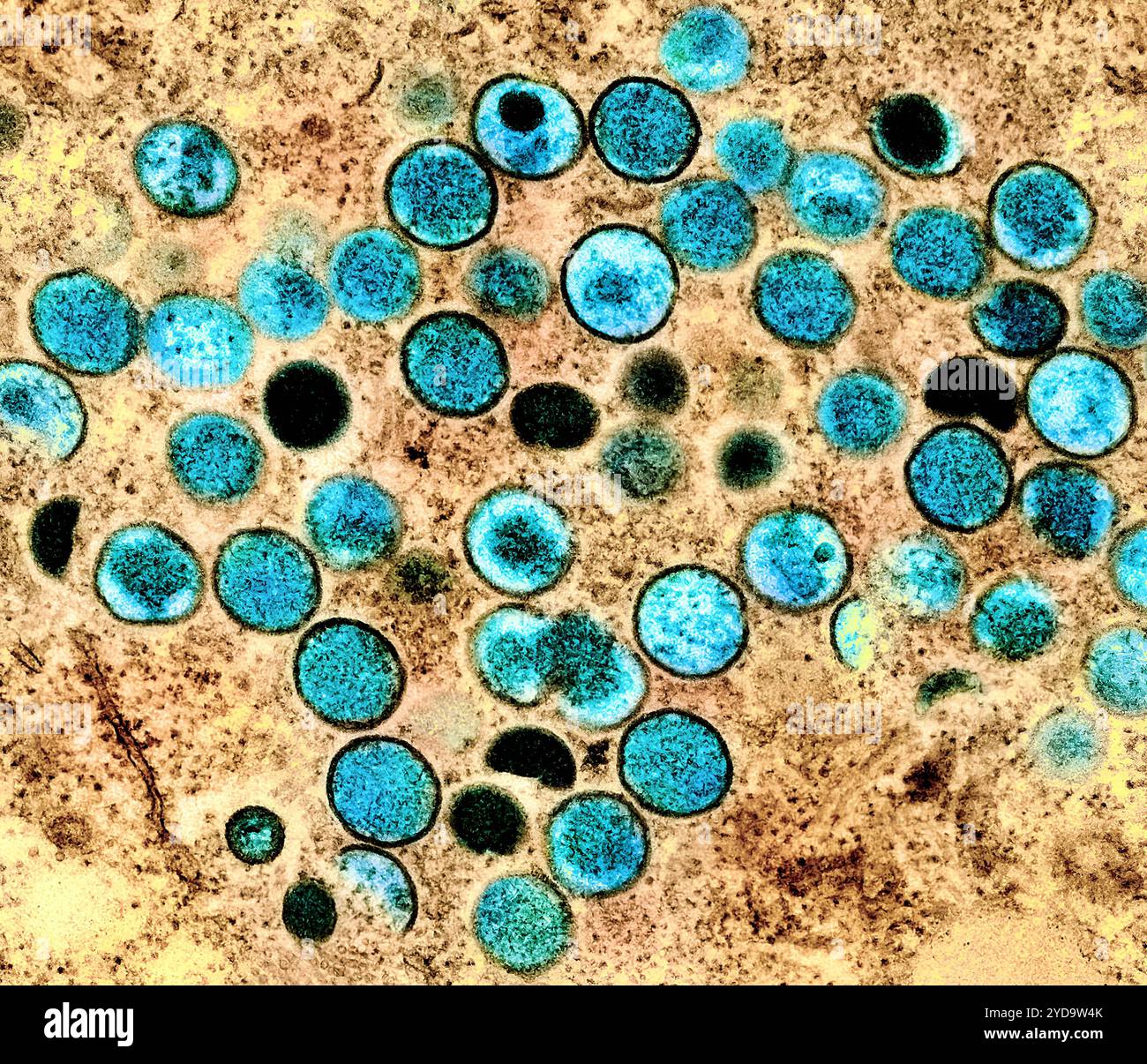 Micrografia elettronica a trasmissione colorata di particelle del virus mpox di tè trovato all'interno di una cellula infetta marrone, coltivato in laboratorio. Virus Mpox 016867_367 Foto Stock
