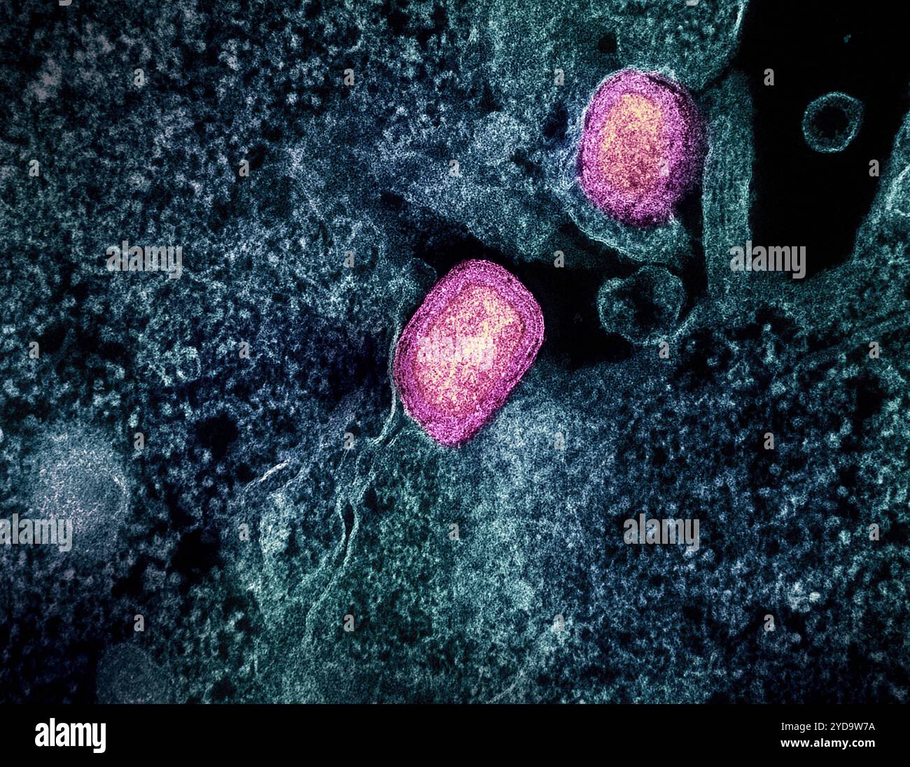 Micrografia elettronica a trasmissione colorata di due particelle di virus mpox maturo rosa attaccate alla superficie di un VERO E6 cellula infetto blu/tè. 2024 : Lower dose of Mpox Vaccine è sicuro e genera una risposta anticorpale a sei settimane equivalente al regime standard. Virus Mpox 016867_390 Foto Stock