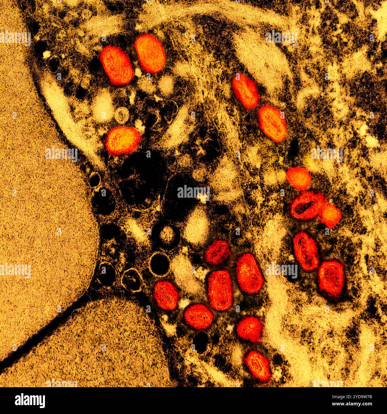 Micrografia elettronica a trasmissione colorata di particelle di virus mpox arancione trovato all'interno di una cellula infetta marrone e giallo, coltivato in laboratorio. Virus Mpox 016867_380 Foto Stock