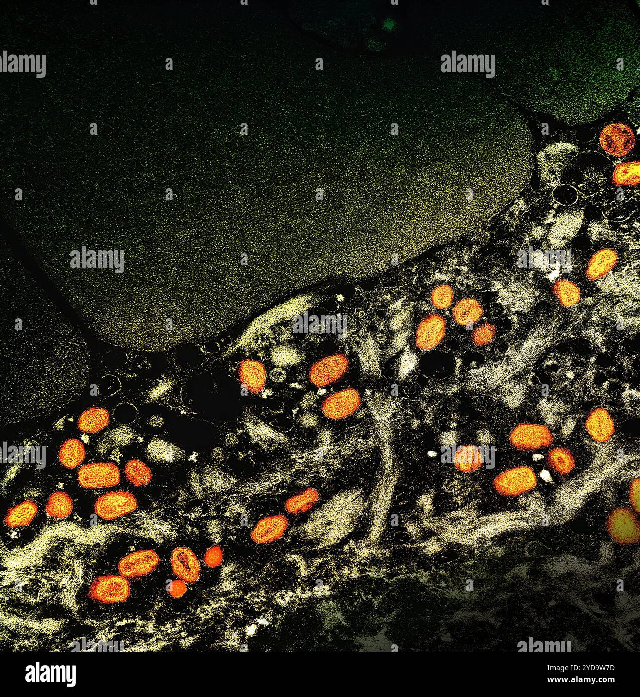 Micrografia elettronica a trasmissione colorata di particelle di virus mpox arancione trovato all'interno di una cellula infetta marrone, coltivato in laboratorio. Virus Mpox 016867_384 Foto Stock