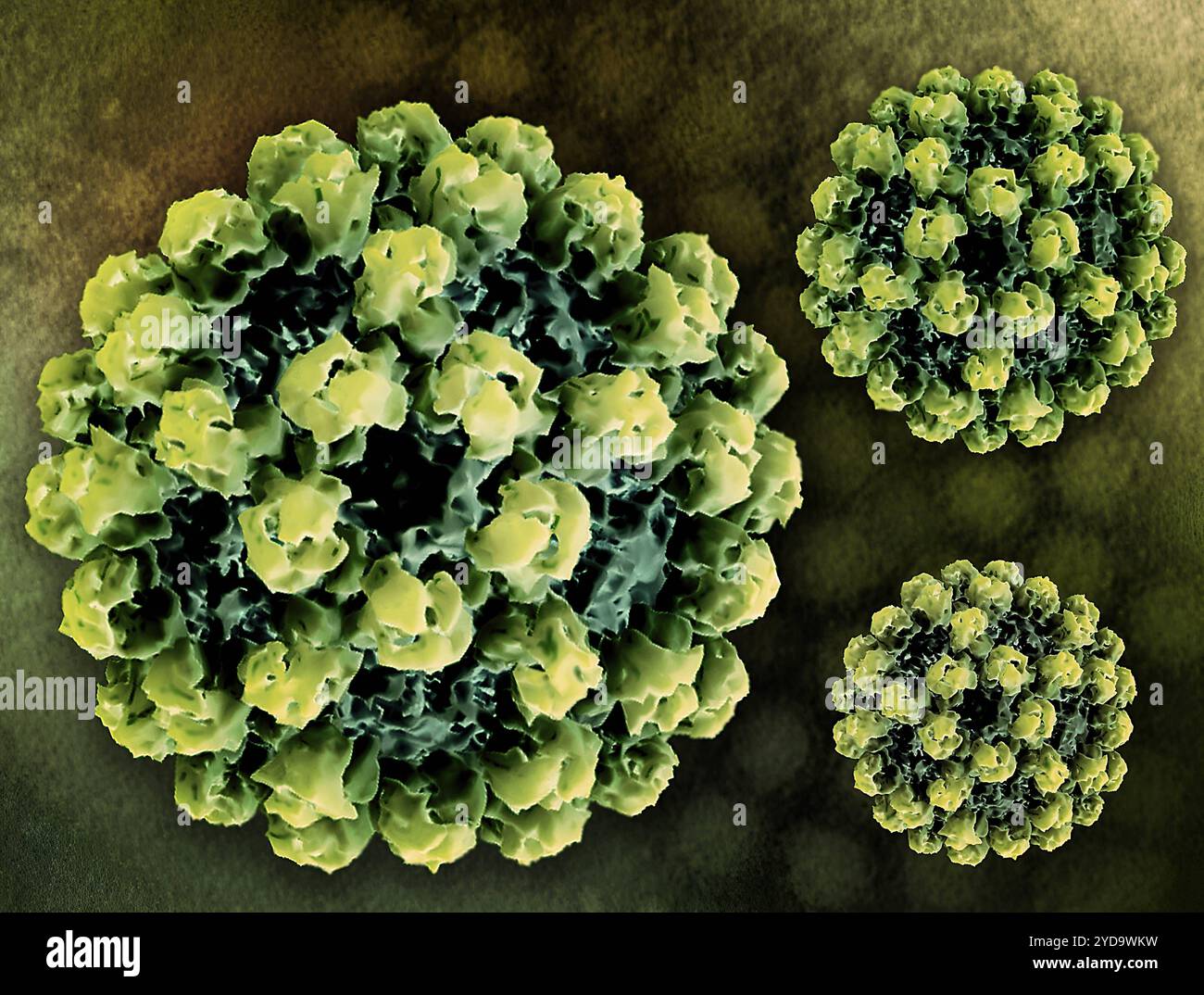 Layout creativo con rendering 3D di particelle simili a virus norovirus VLP, generate dalla microscopia elettronica, e un micrografo elettronico di trasmissione di particelle norovirus sullo sfondo. Norovirus 016867_436 Foto Stock