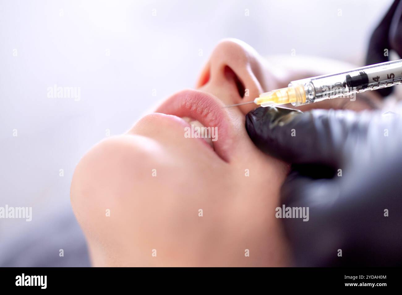 Iniezioni di bellezza. Cosmetologa donna in guanti neri fa un'iniezione Foto Stock