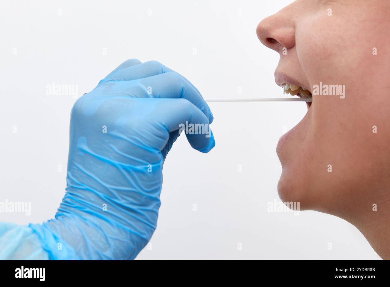 Medico in tuta protettiva che prende una gola e un tampone nasale da un paziente per verificare la possibile infezione da coronavirus o covid Foto Stock