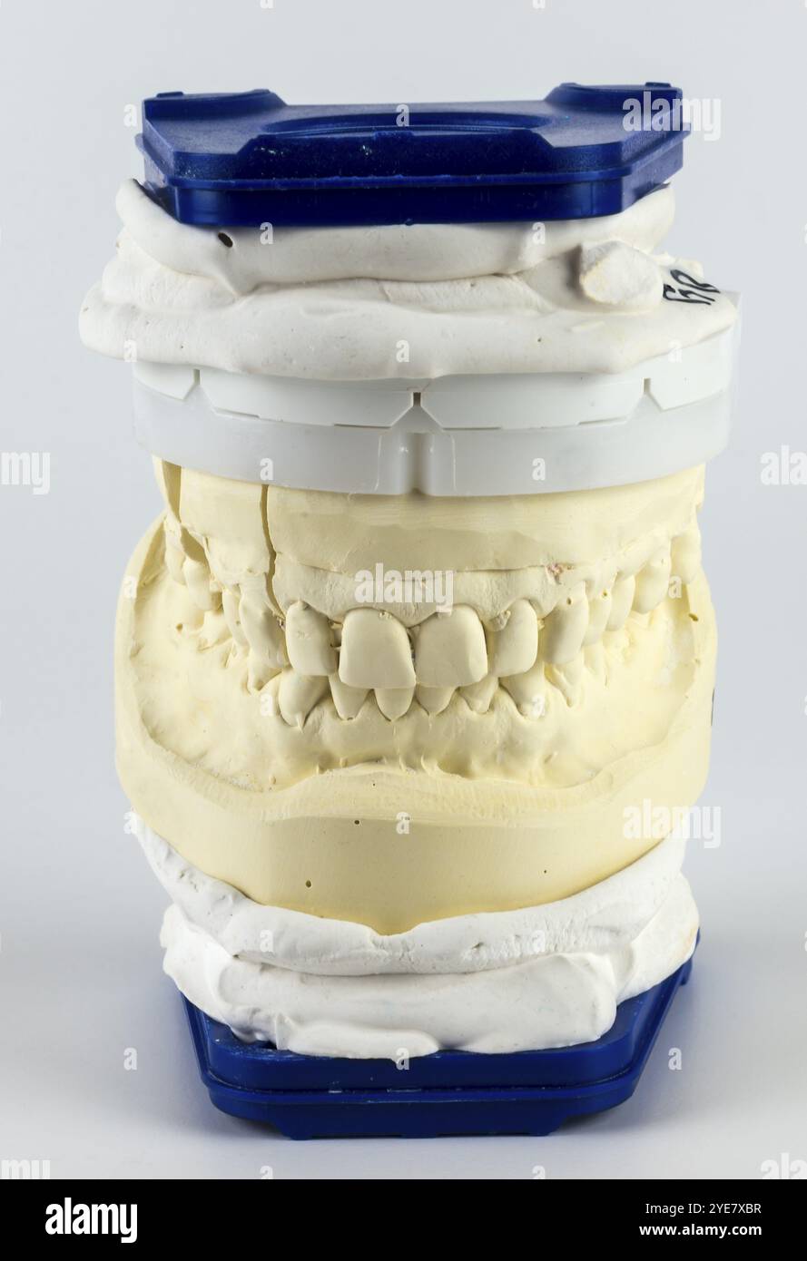 Modello dentale verticale in blu e bianco, mostra la mascella superiore e inferiore in gesso in dettaglio Foto Stock