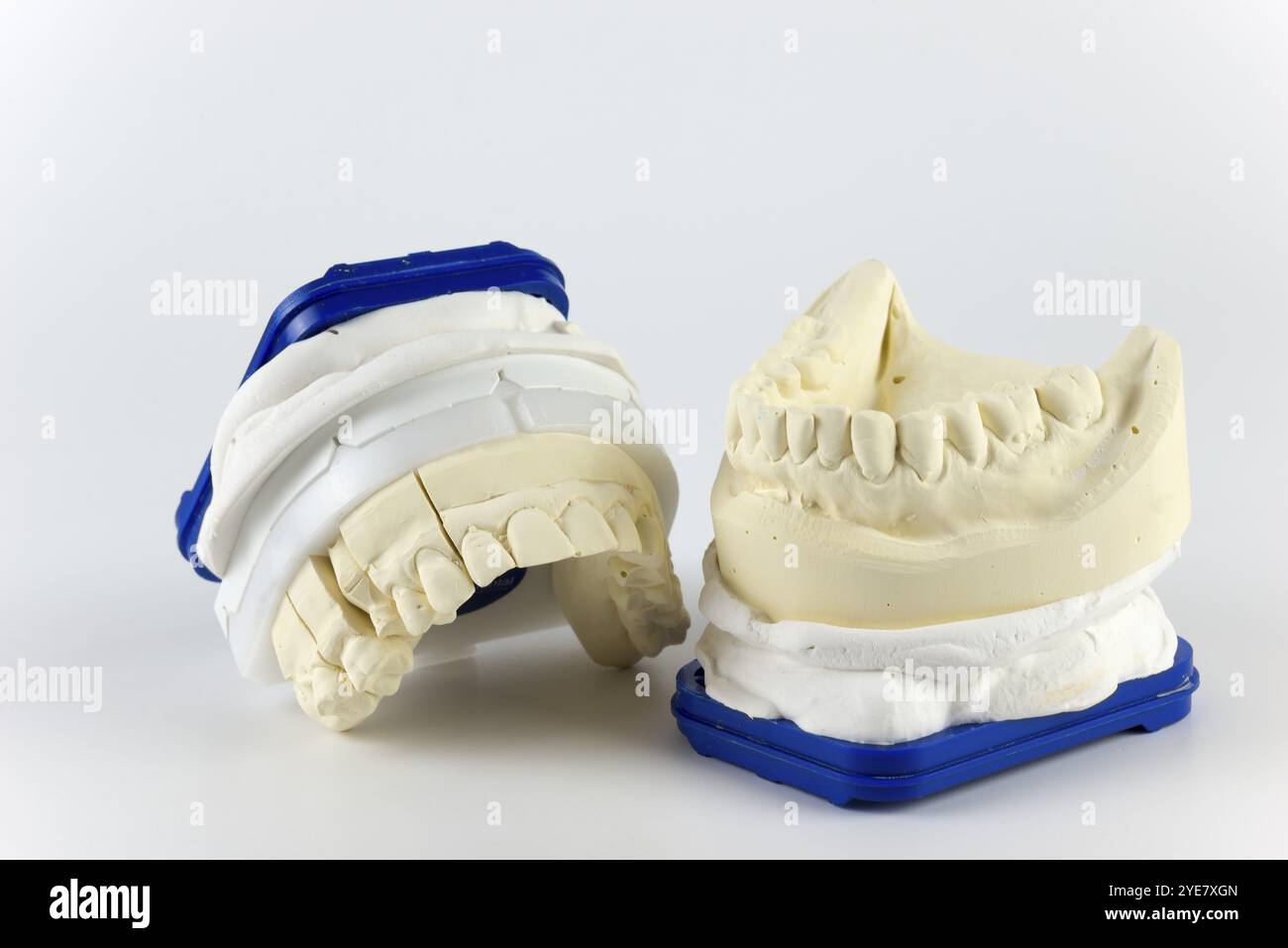 Due gesso dentario con bordo blu su sfondo bianco, che rappresentano la fila superiore e inferiore dei denti, impronta per la fabbricazione di un Foto Stock