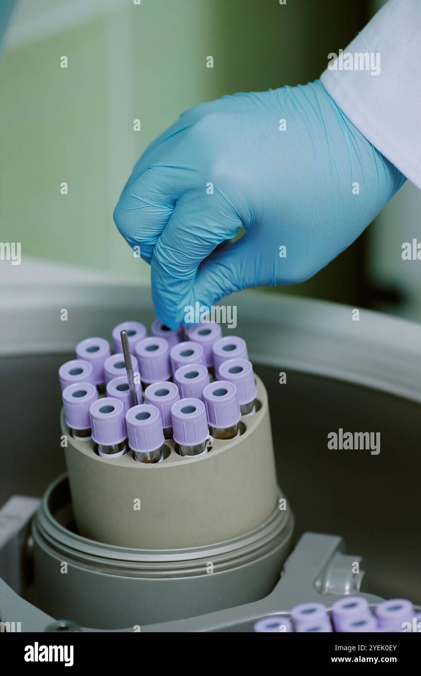 Posizionamento manuale delle provette per analisi con guanti in una macchina per centrifuga in laboratorio. Apparecchiature di laboratorio visibili, che dimostrano un'attenta manipolazione dei campioni Foto Stock