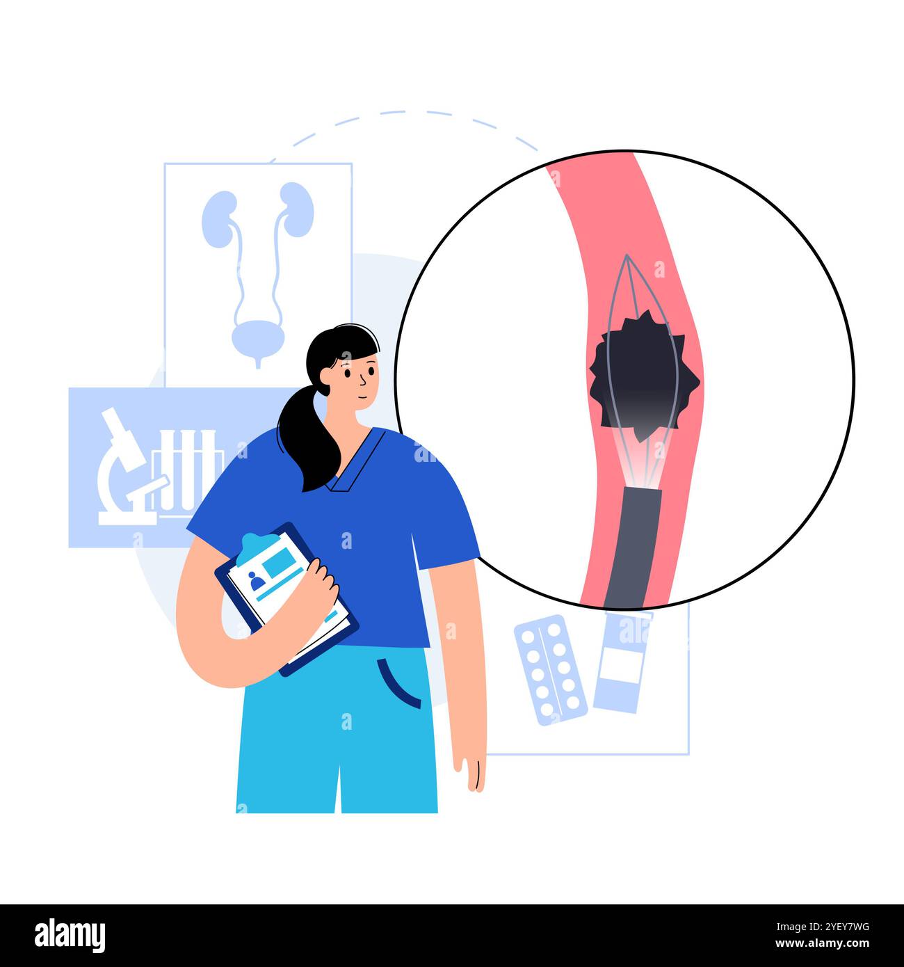 Illustrazione concettuale di una procedura ureteroscopica. Si tratta di una procedura eseguita per esaminare o trattare problemi nel tratto urinario, come i calcoli renali. Foto Stock