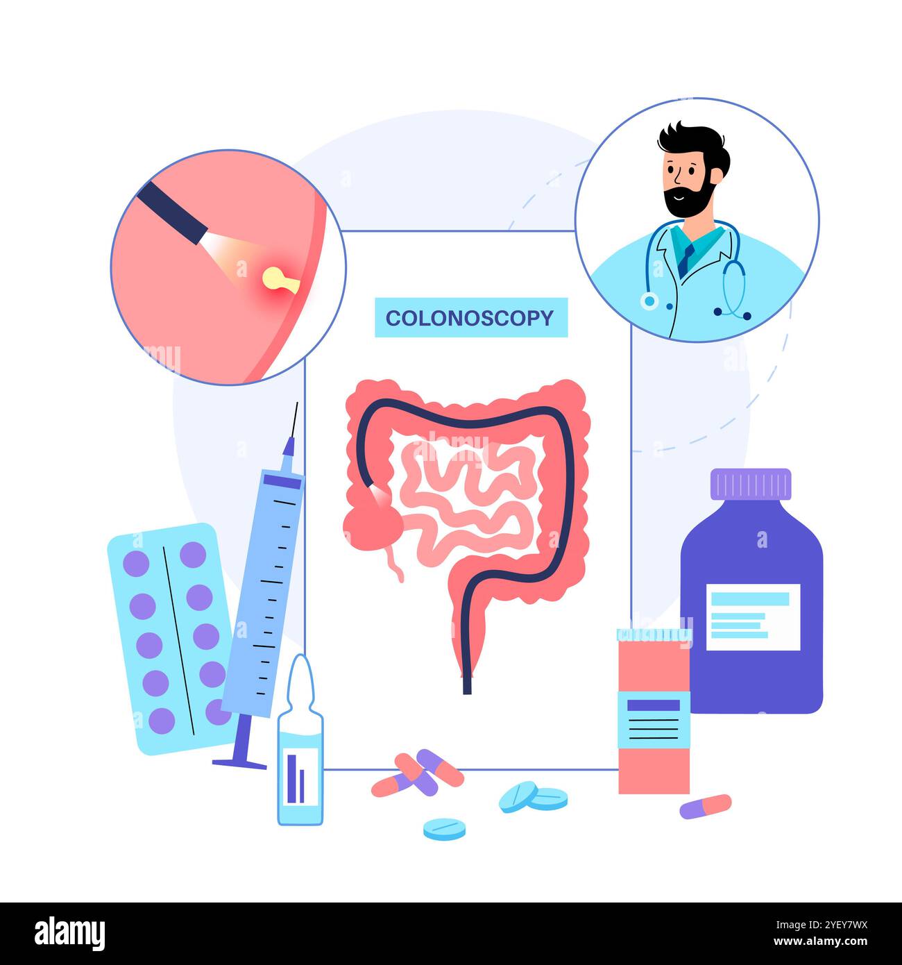 Illustrazione concettuale di una procedura di colonscopia. Questo è un esame dell'interno del vostro intestino crasso, che comprende il colon, il retto e l'ano. Può essere utilizzato per esplorare le possibili cause di dolore addominale, sanguinamento rettale, diarrea cronica e altri problemi gastrointestinali. Viene utilizzato anche per cercare possibili segni di cancro colorettale o polipi. Foto Stock