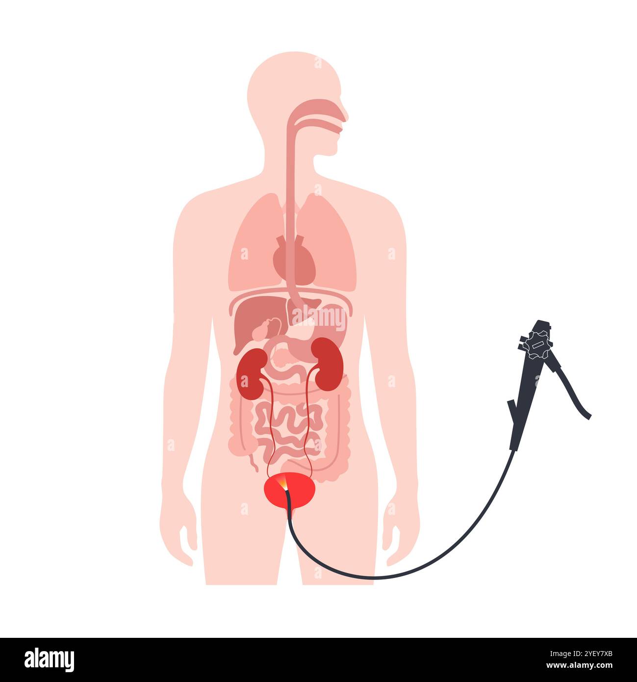 Illustrazione concettuale di una procedura di cistoscopia. Si tratta di una procedura utilizzata per diagnosticare, monitorare e trattare le condizioni che interessano la vescica e l'uretra. Foto Stock