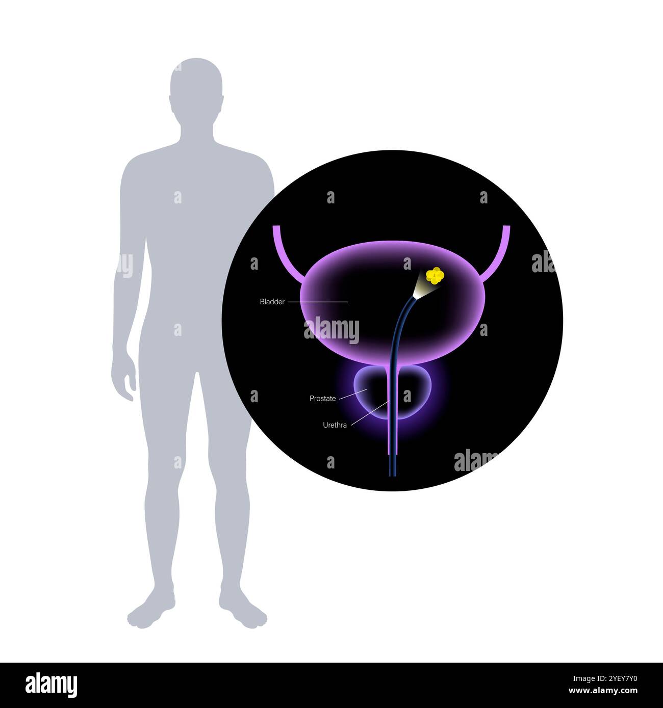 Illustrazione concettuale di una procedura di cistoscopia. Si tratta di una procedura utilizzata per diagnosticare, monitorare e trattare le condizioni che interessano la vescica e l'uretra. Foto Stock