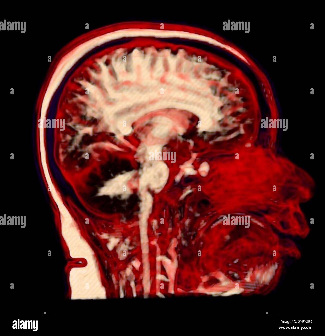 Risonanza magnetica colorata (MRI) scansione di un cervello umano sano. Foto Stock