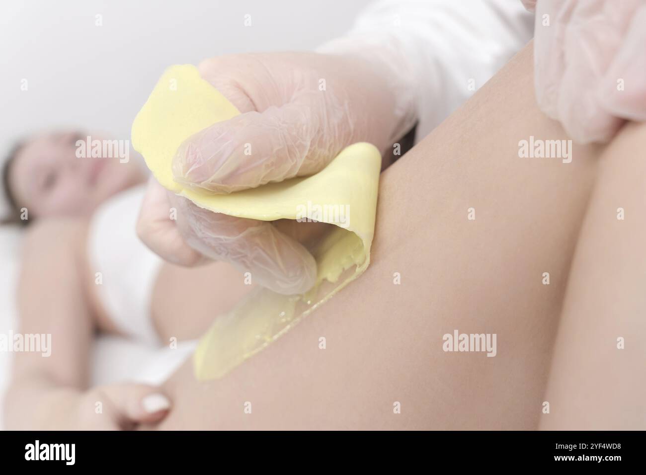 Processo di ceratura, vista ravvicinata del rapido movimento improvviso del panno con cera calda verde in un salone di bellezza professionale. Cosmetologo che rimuove i capelli sulle donne l Foto Stock