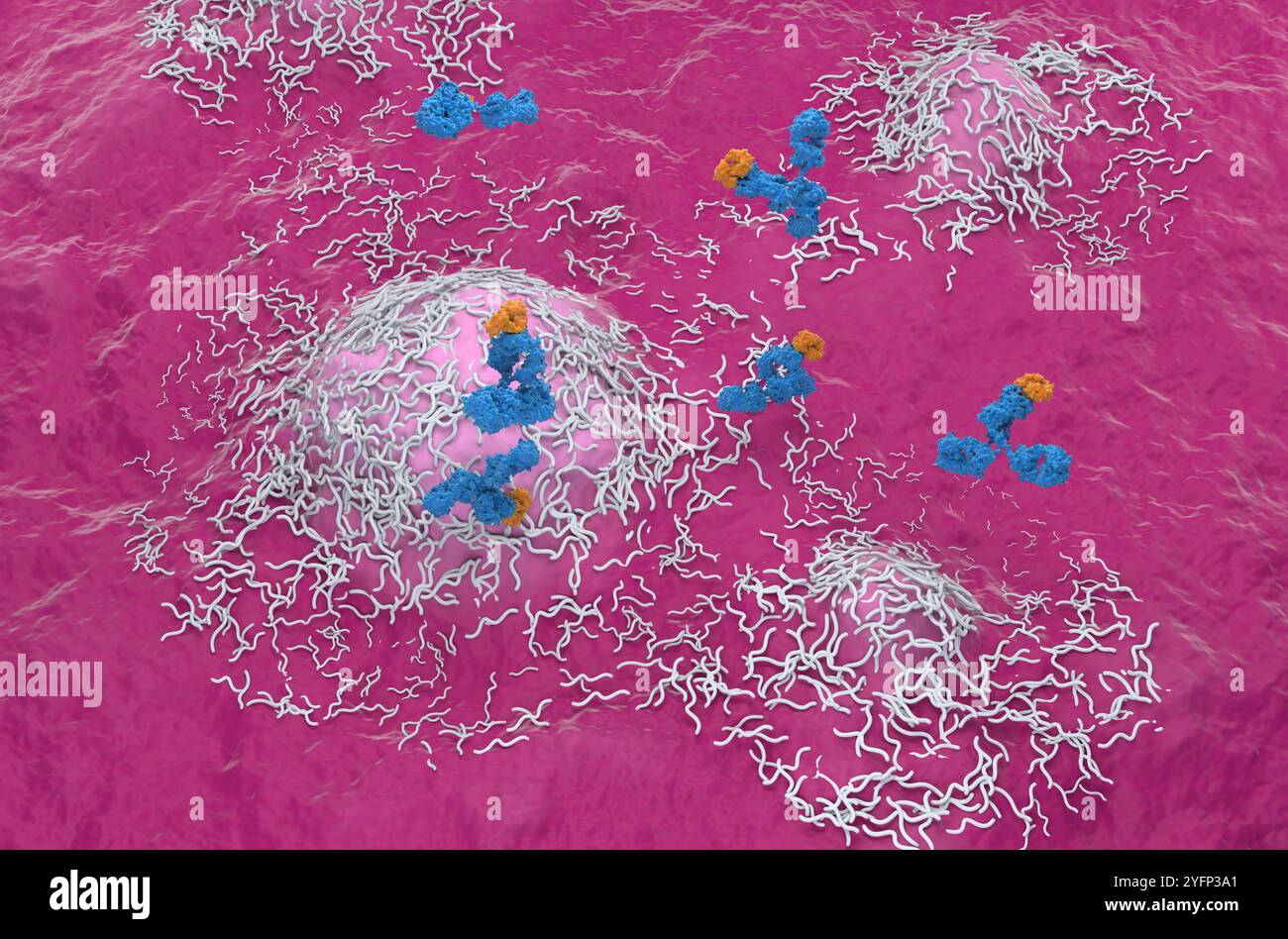 Terapia con anticorpi monoclonali in Ependymoma - visualizzazione isometrica illustrazione 3d. Foto Stock