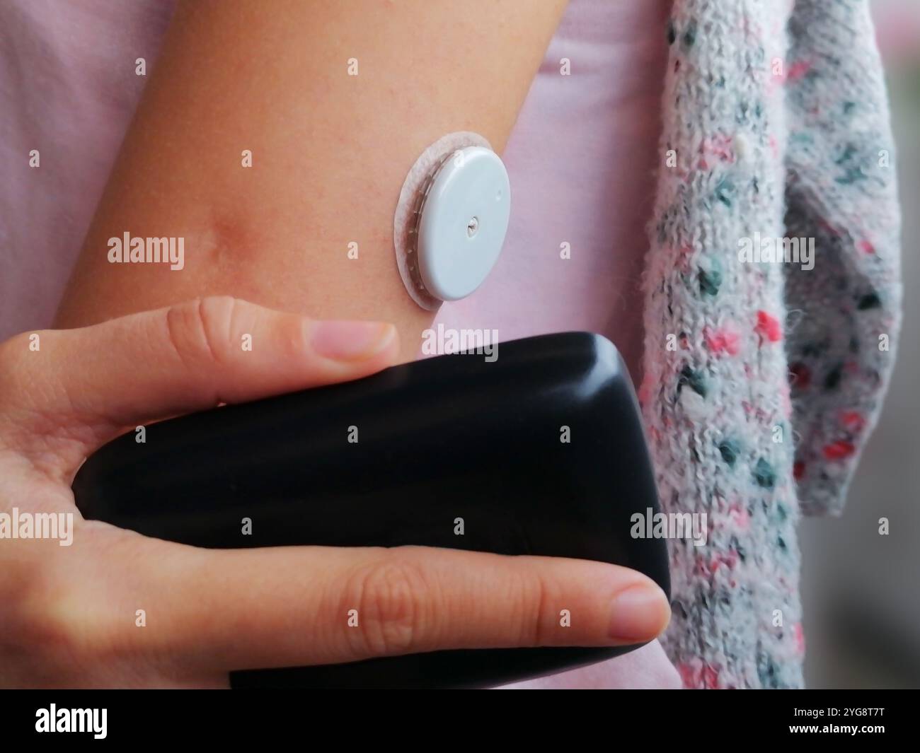 Attivazione e lettura del sensore per il monitoraggio continuo del glucosio – CGM. Diabete di tipo 1. L'insulina dipende. Foto Stock