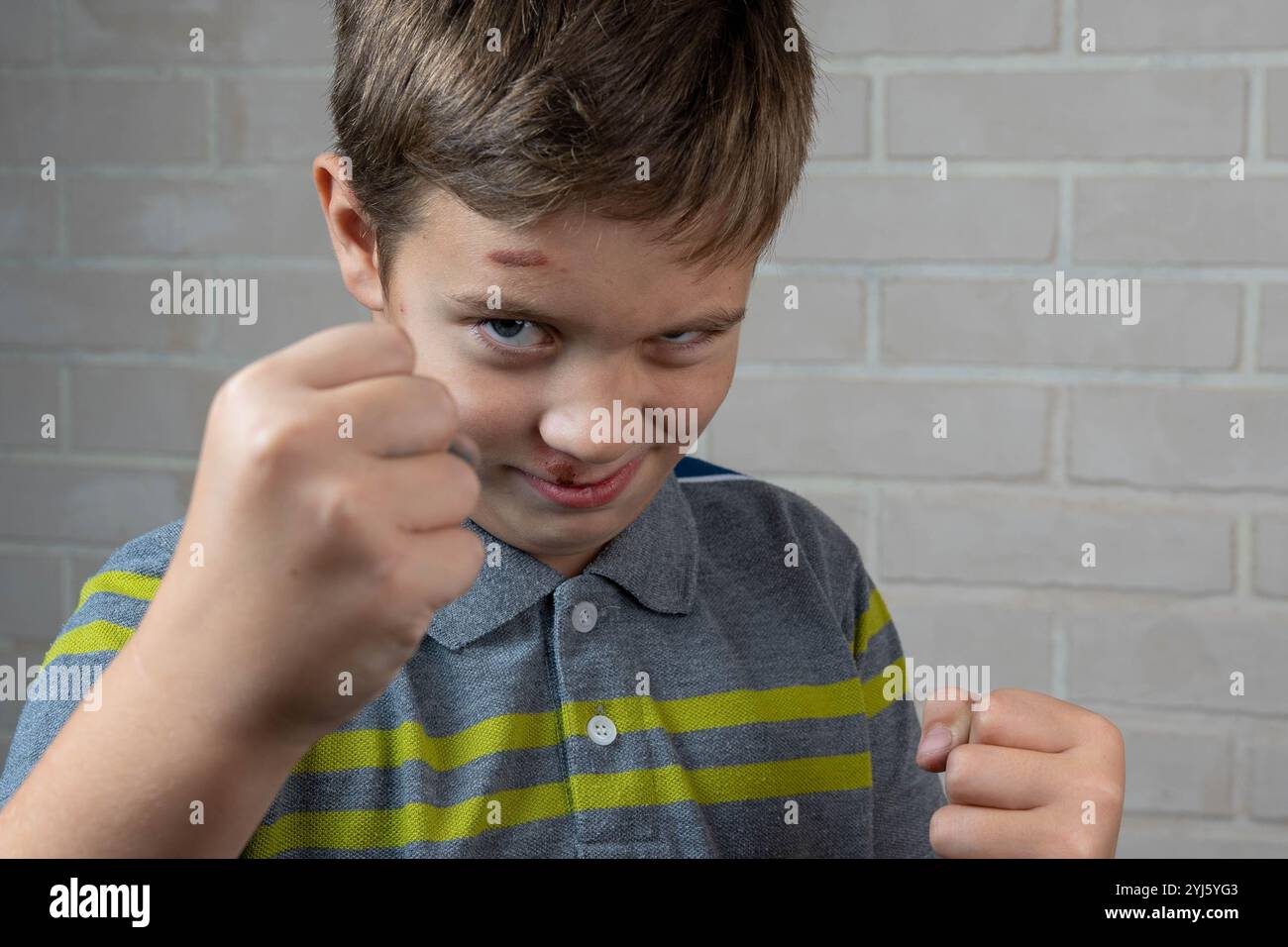 Ragazzo aggressivo che mostra pugni, con un graffio sulla fronte e un livido sotto il naso Foto Stock