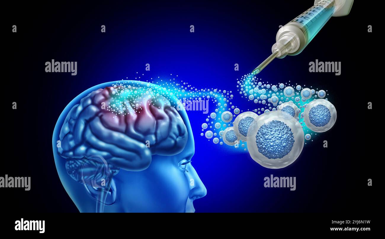 Neurale Stem Cell Therapy o Neuroregenerative Regenerative Medicine iniettata per rigenerare il tessuto cerebrale per malattie neurodegenerative Medical illustr Foto Stock