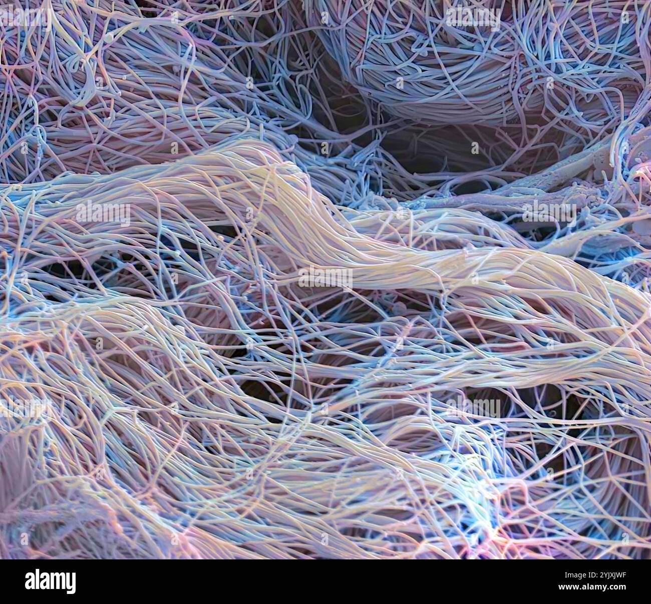 Tessuto connettivo. Micrografia elettronica a scansione colorata (SEM) di collagene da una biopsia in polietilene nasale. Il collagene è una proteina con un'elevata resistenza alla trazione, che fornisce struttura ed elasticità all'epitelio, ai tendini, ai legamenti e alle ossa. È la proteina più abbondante del corpo. Nel derma, il collagene forma fibre simili a funi disposte in modo irregolare. Ingrandimento: X1300 se stampato largo 10 centimetri. Foto Stock