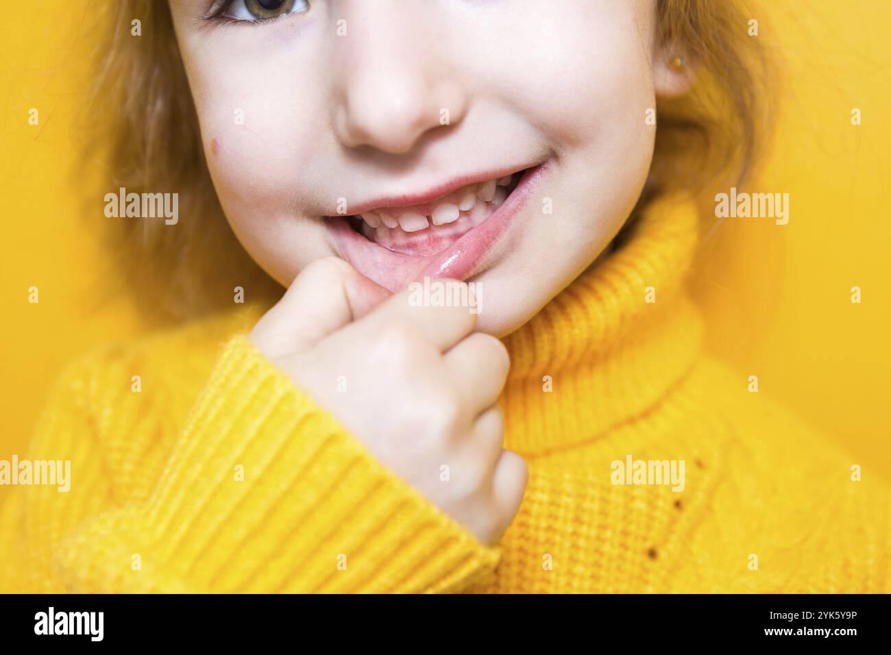 Ragazza mostra i denti-morso patologico, malocclusione, overbite. Odontoiatria pediatrica e parodontica, correzione del morso. Salute e cura dei denti, carie Foto Stock