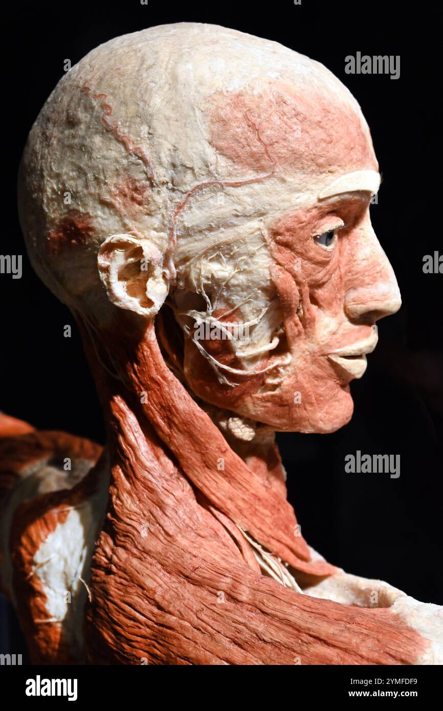 Budapest, Ungheria - 5 febbraio 2023 - Headshot of Human body from Body Worlds Exhibition Foto Stock