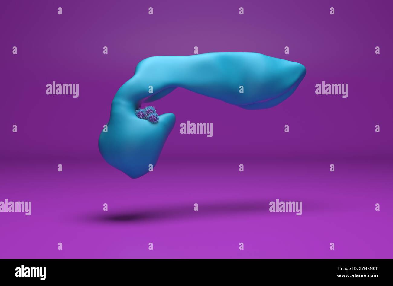 Cancro del pancreas - Vista isometrica illustrazione 3d. Foto Stock