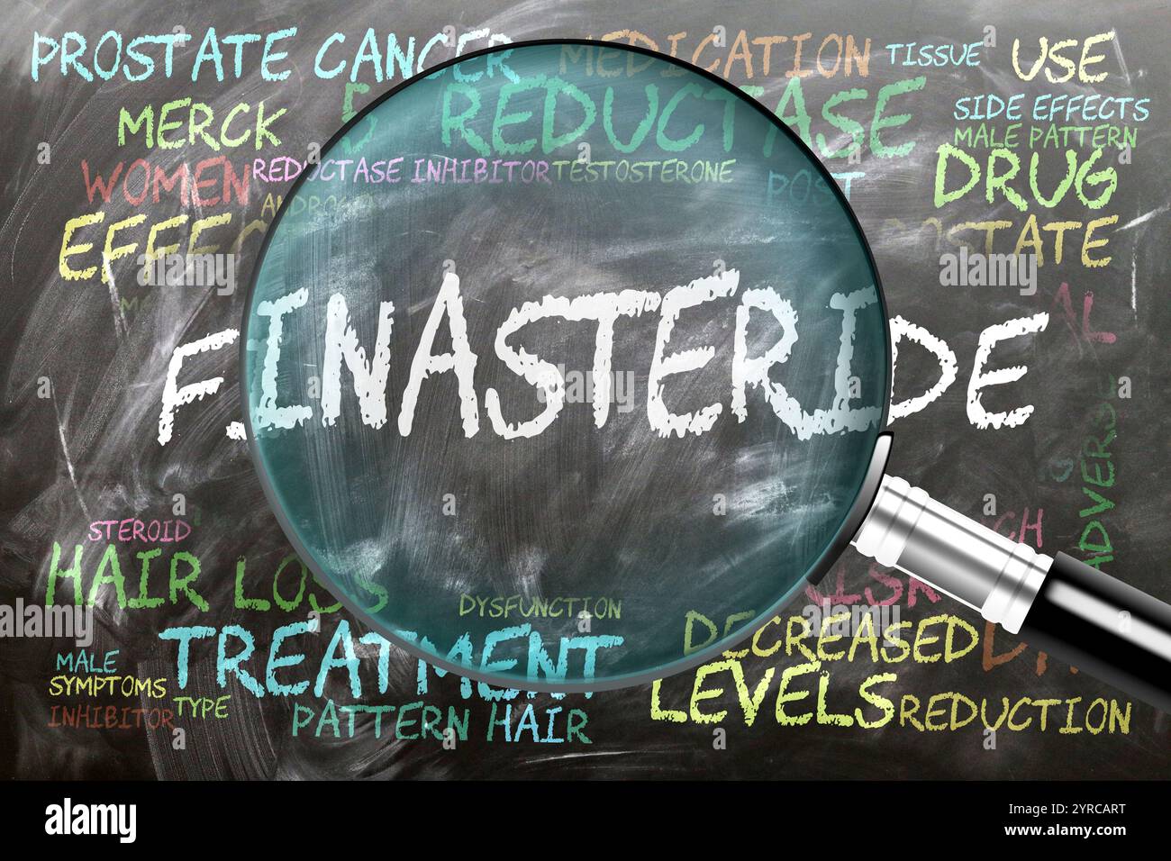 Finasteride in fase di studio, esame - sotto stretta ispezione. Argomenti e idee più importanti strettamente correlati al finasteride scritto su una lavagna Foto Stock