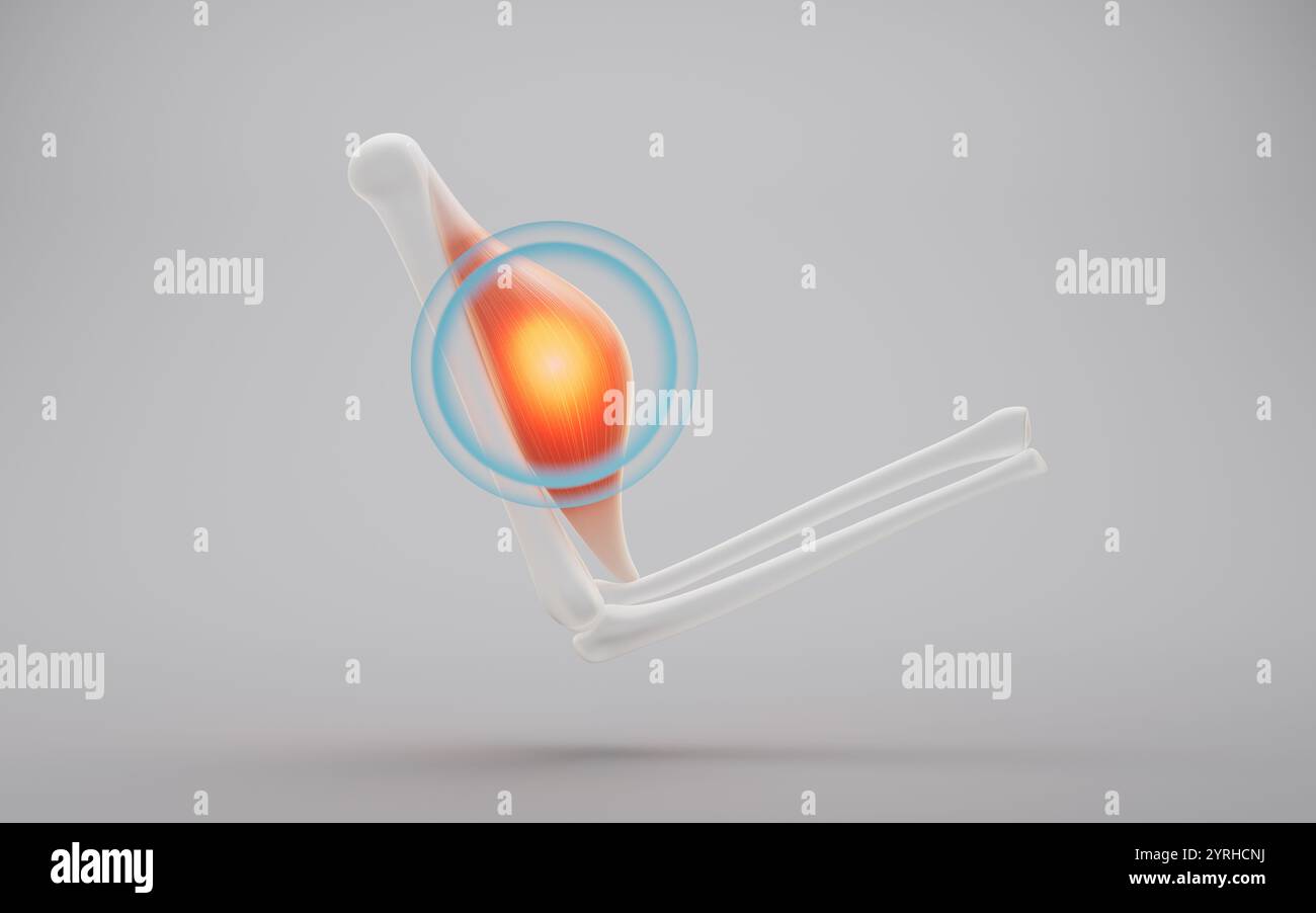 Struttura muscolare, malattie e concetto medico, rendering 3d. Illustrazione 3D. Foto Stock