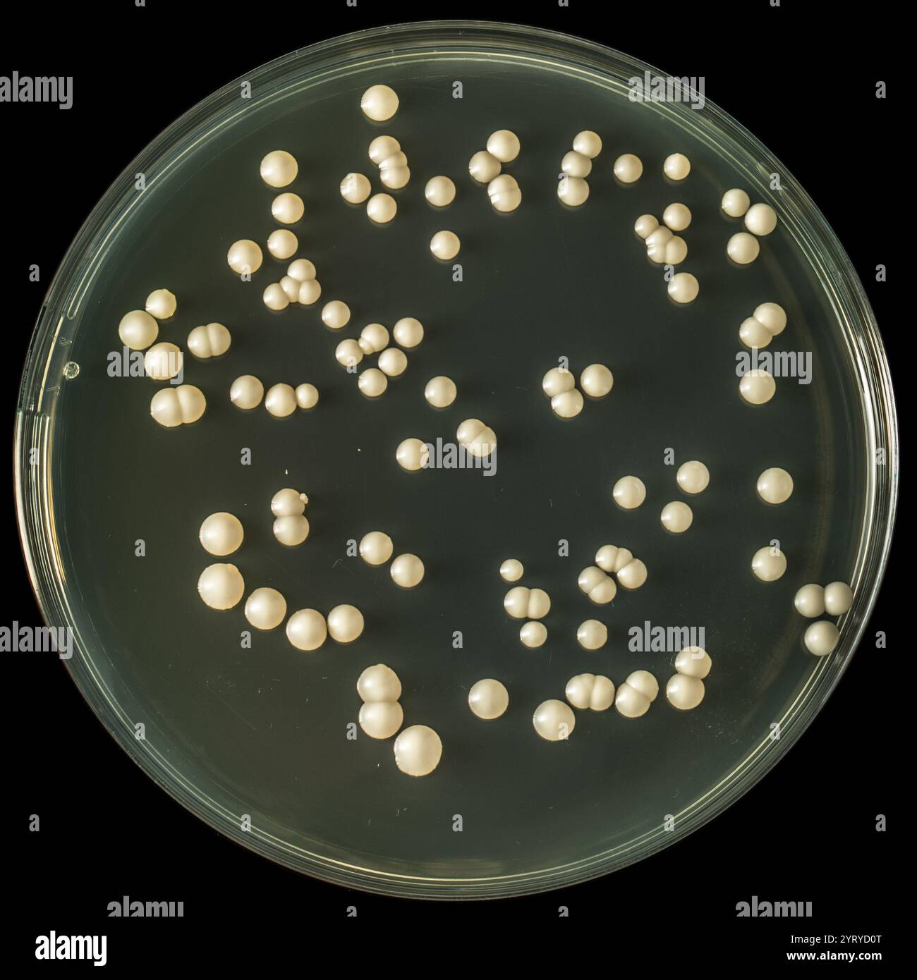 Primo piano di colonie di lieviti candida albicans che crescono su una piastra di Petri in un laboratorio di microbiologia Foto Stock Primo piano di colonie di lieviti candida albicans che crescono su una piastra di Petri in un laboratorio di microbiologia Foto Stock