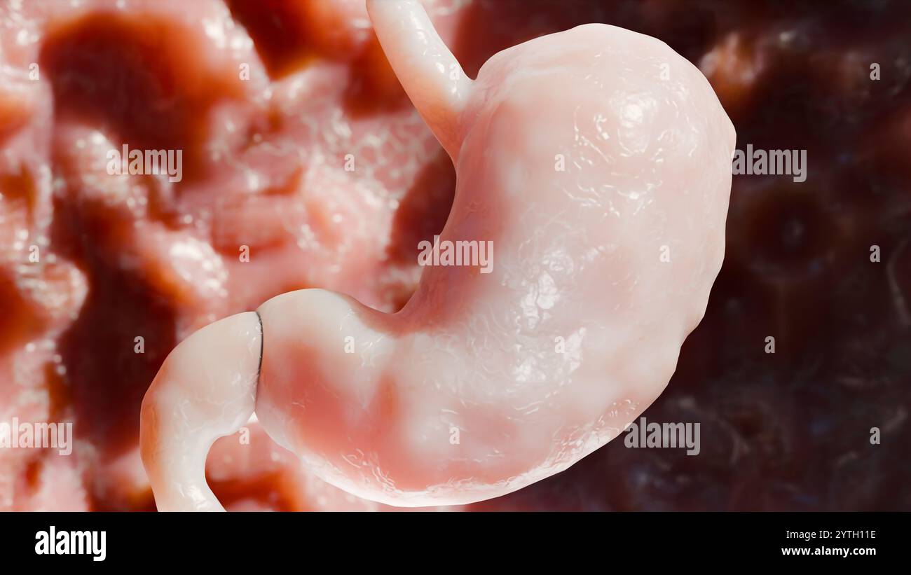 Stomaco umano anatomia digestione, esofago addome gastrico con digestivo acido, contrazione della parete dello stomaco, organo interno, intestino gastrico, processo di brea Foto Stock